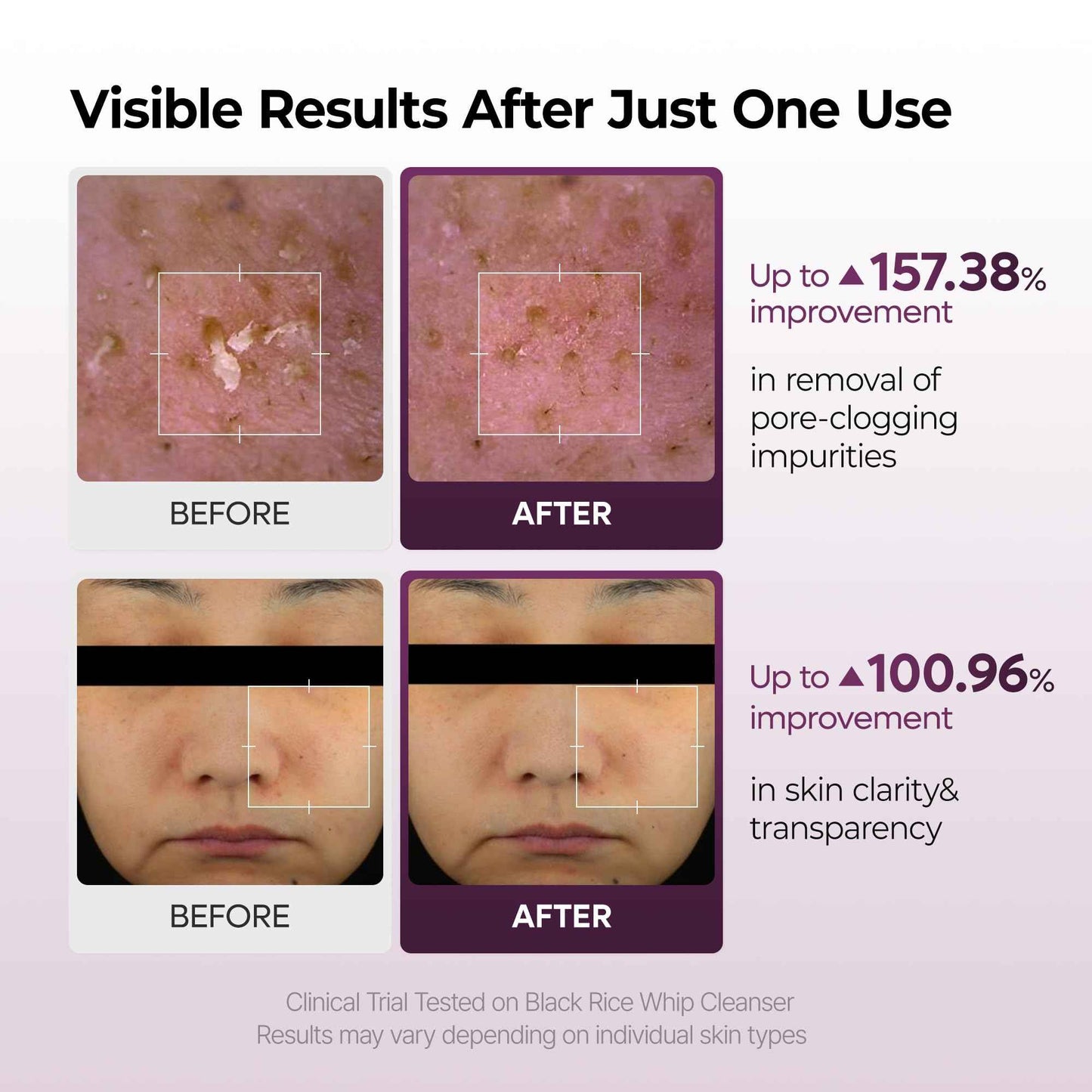 Dr.Melaxin Peel Shot Black Rice Mochi Whip Cleanser 100ml formulated for blackheads, clogged pores, excess sebum, and dull skin