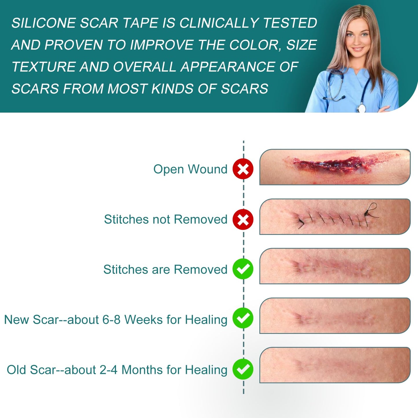 SLUKHIG Silicone Scar Sheets (1.6"x 158" Roll-4M), Silicone Scar Tape for Scar Removal Treatment, Reusable Silicone Scar Strips for C-Section, Keloid, Burn, Acne, Surgical Scars