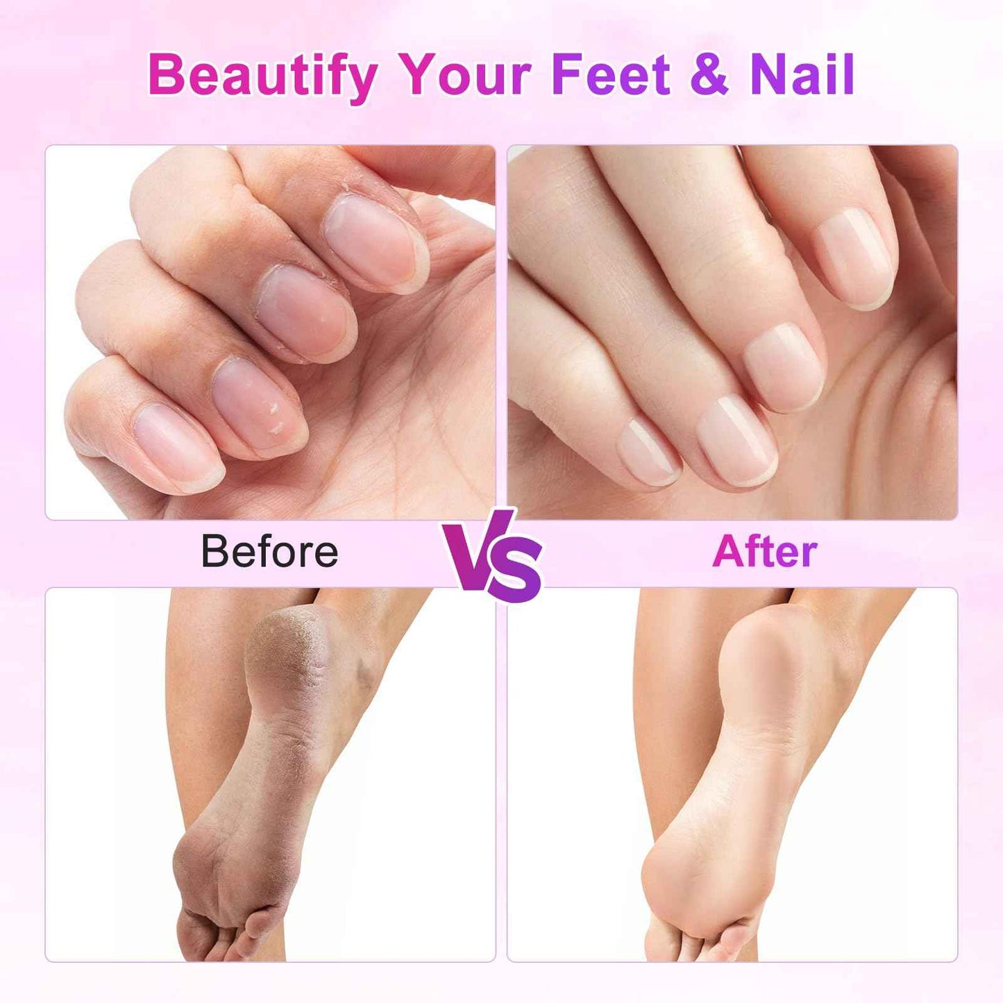 Electric Foot File, 2 in 1 Electric Foot Callus Remover, Adjustable 9 Speed Rechargeable Pedicure Foot Filer with LED Display, Replaceable Sandpaper Discs & Nail Bands (Rose Gold)