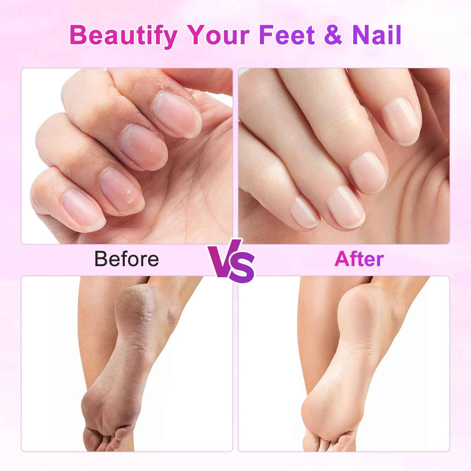 Electric Foot File, 2 in 1 Electric Foot Callus Remover, Adjustable 9 Speed Rechargeable Pedicure Foot Filer with LED Display, Replaceable Sandpaper Discs & Nail Bands (Rose Gold)