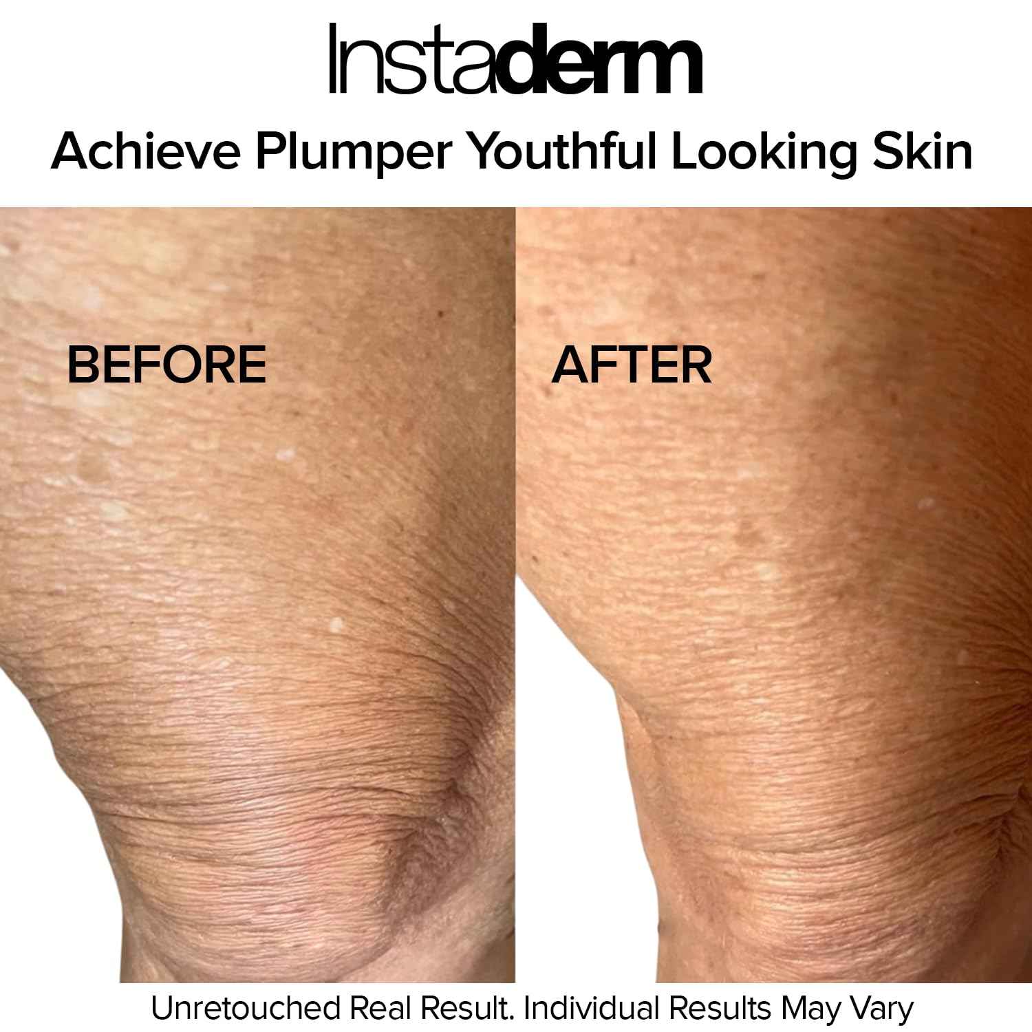 Instaderm Crepe Fix Body Restorative Cream – Anti-Aging Wrinkle Cream, Support Skins Natural Elastin & Collagen Production to Restore, Lift, Tighten, Hydrate & Smooth Thinning Aged Crepey Skin. 4OZ