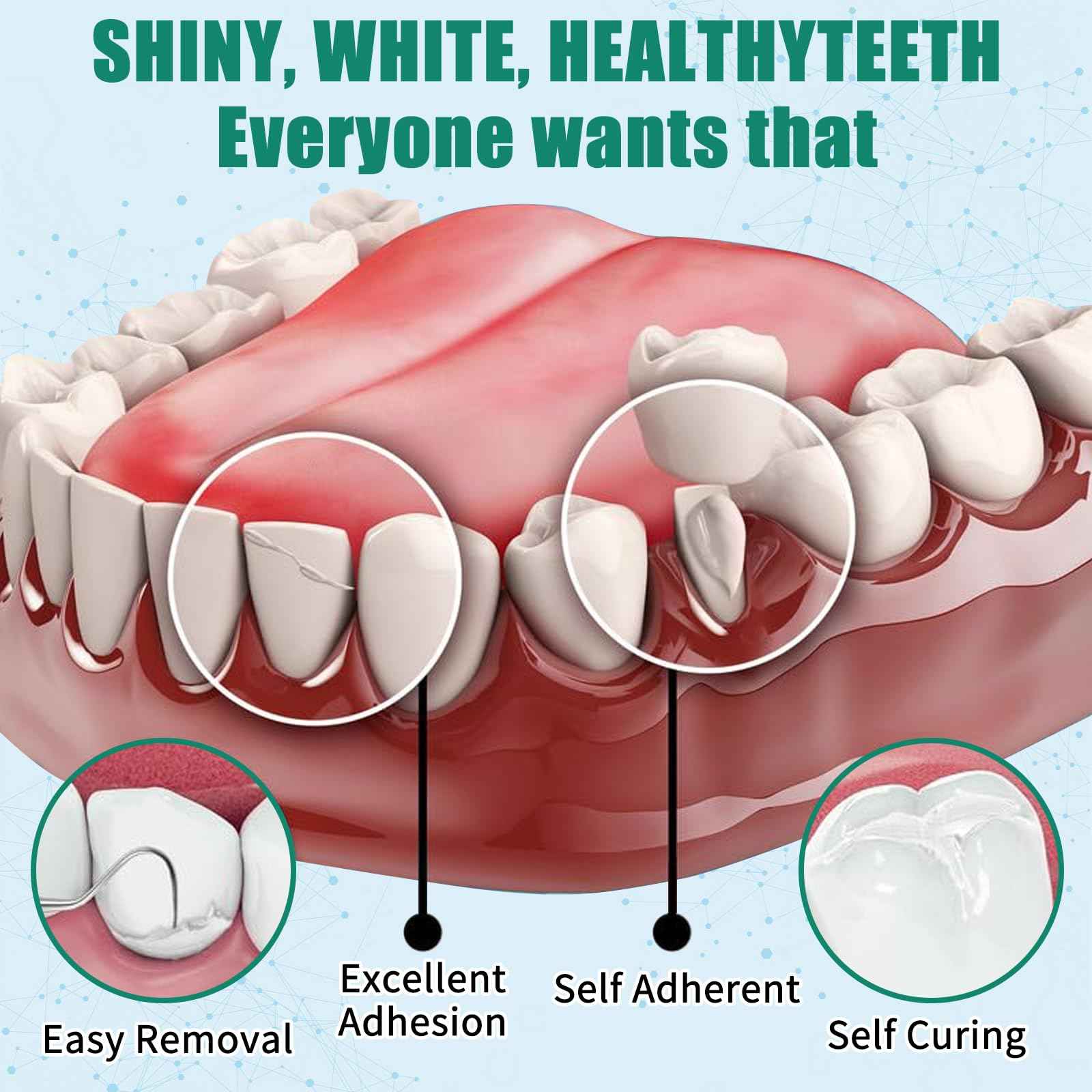 Temporary Replacement Tooth Repair Kit, Zinc Oxide Eugenol Cement Dental Care Kit Glue for Crowns & Bridges Filling, Perfect Smile (6)