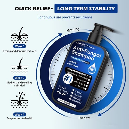 Antifungal Shampoo for Seborrheic Dermatitis, Folliculitis & Scalp Psoriasis, Anti-Dandruff Shampoo for Men & Women, Relieves Scalp Itching, Dryness, Sulfate & Paraben-Free, 10.1 Fl Oz