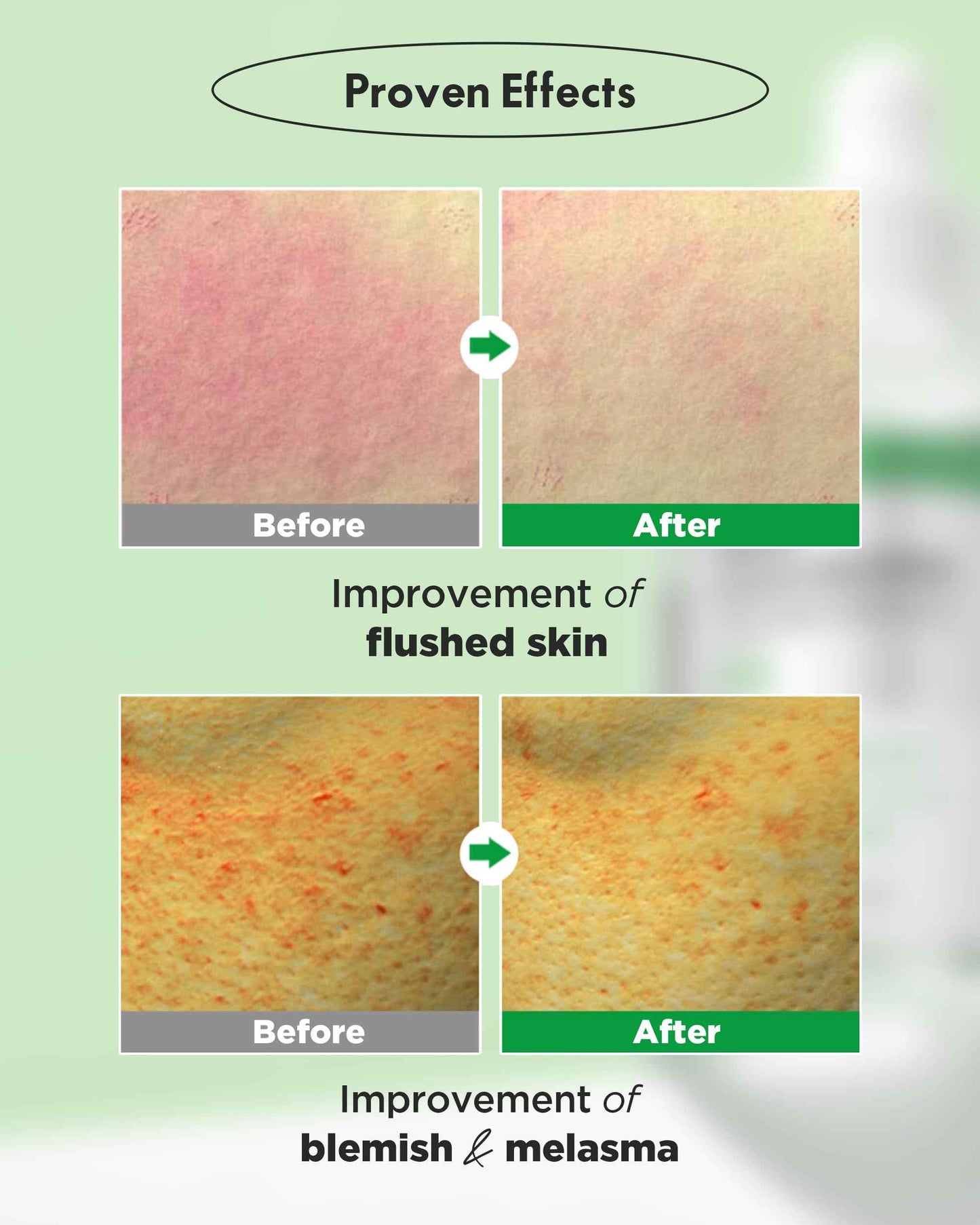 WELLAGE Real Cica Calming Trouble Ampoule - Korean Skincare Soothing Serum, Madecassoside Centella Asiatica Panthenol Niacinamide, Relief Redness, Sebum Control, Improves Blemishes, 1.69 fl.oz.