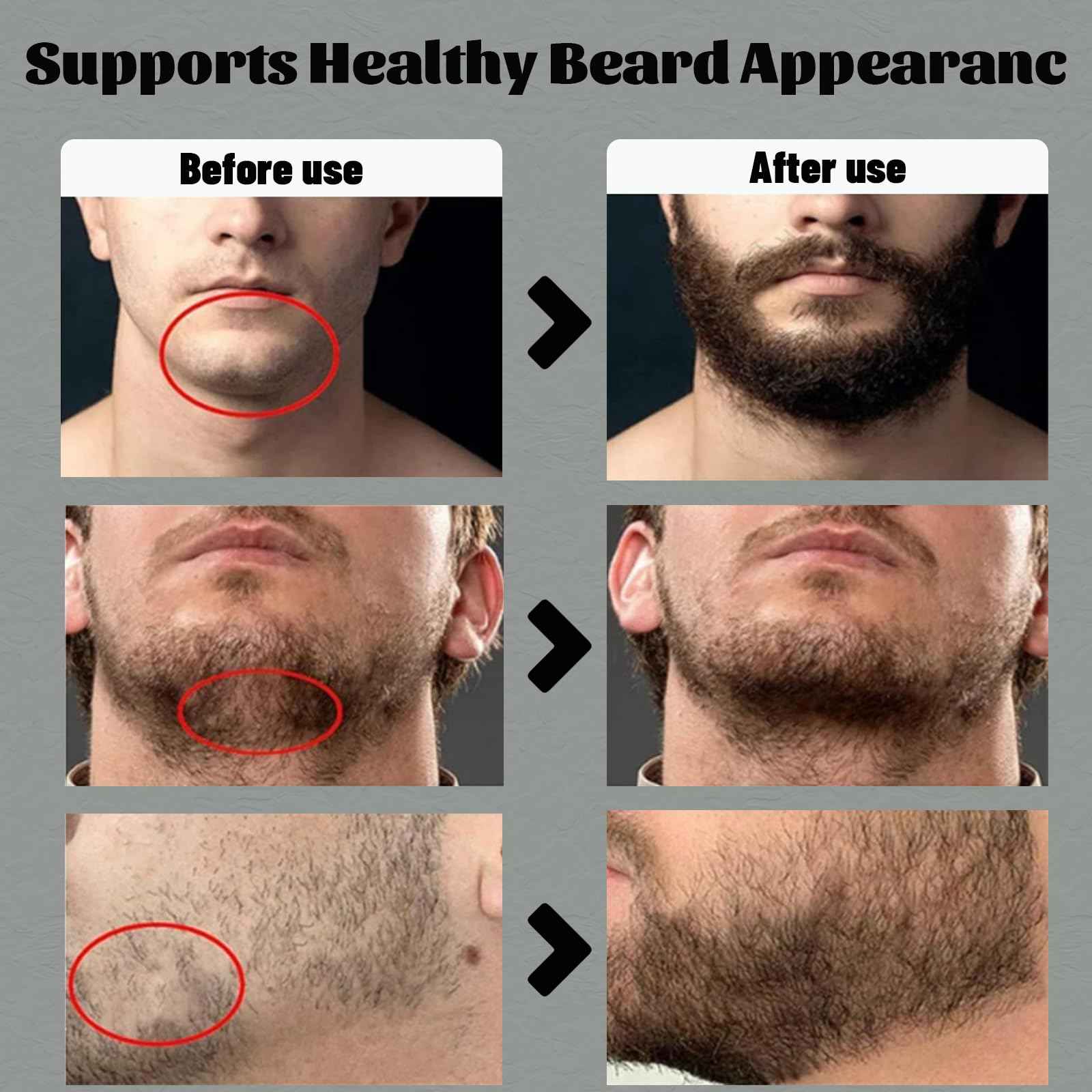 Para Barba, Crecimiento De Barba Para Hombre, Beard Stimulating Balm Beard Cream, Estimulante De Barba Ultra Potente, Beard Balm for Men Growth Oil, Balsamo Negro Moisturizes Strengthens (1PCS)