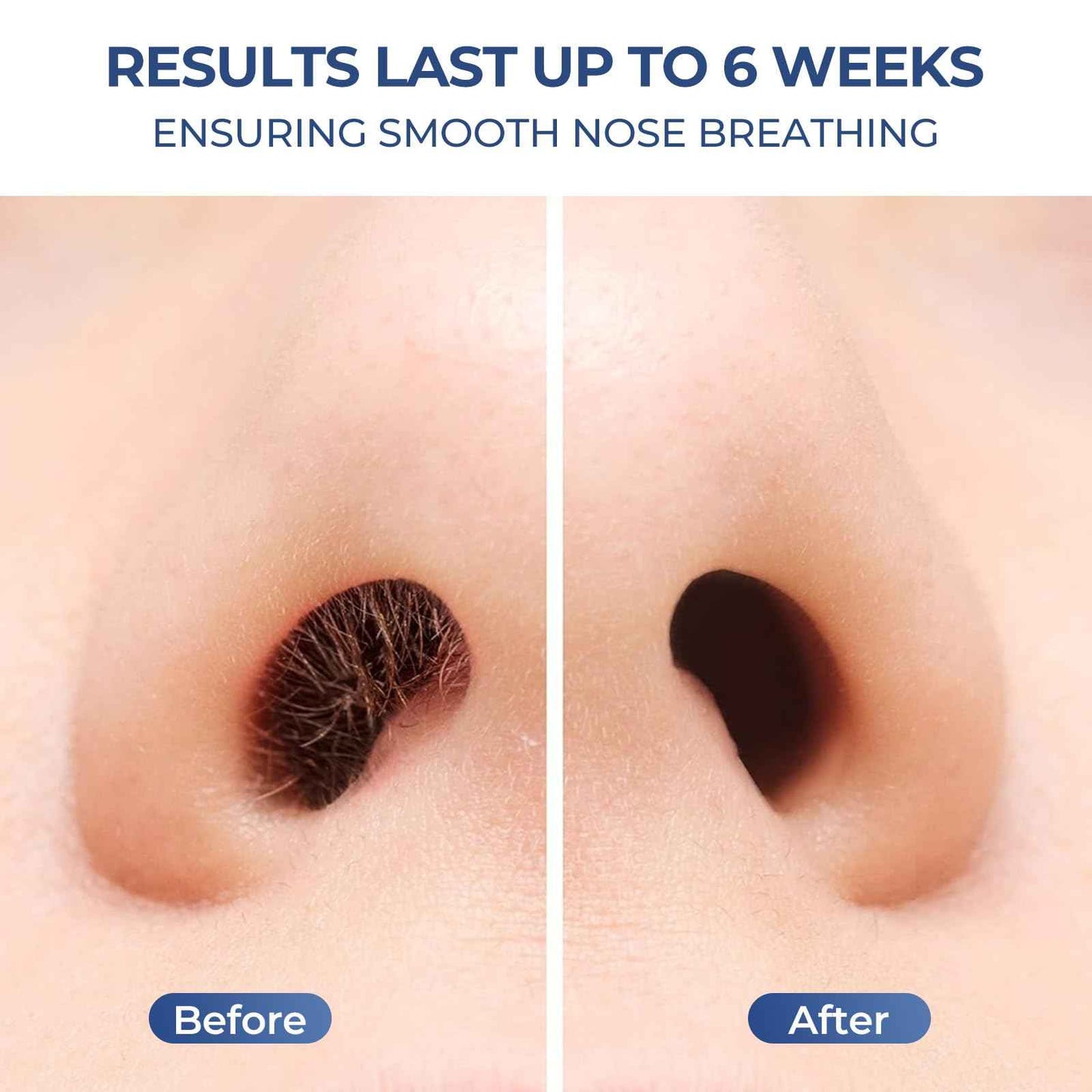 SUERBEATY Nose Wax Kit Men, Nose Hair Wax Kit with 100 g Nose Wax, Use 20 Times, Nose and Ear Hair Removal Kit For Men, USB Fast Heat, Constant Temperature, Multi-Accessories, Travel Use, Light Black