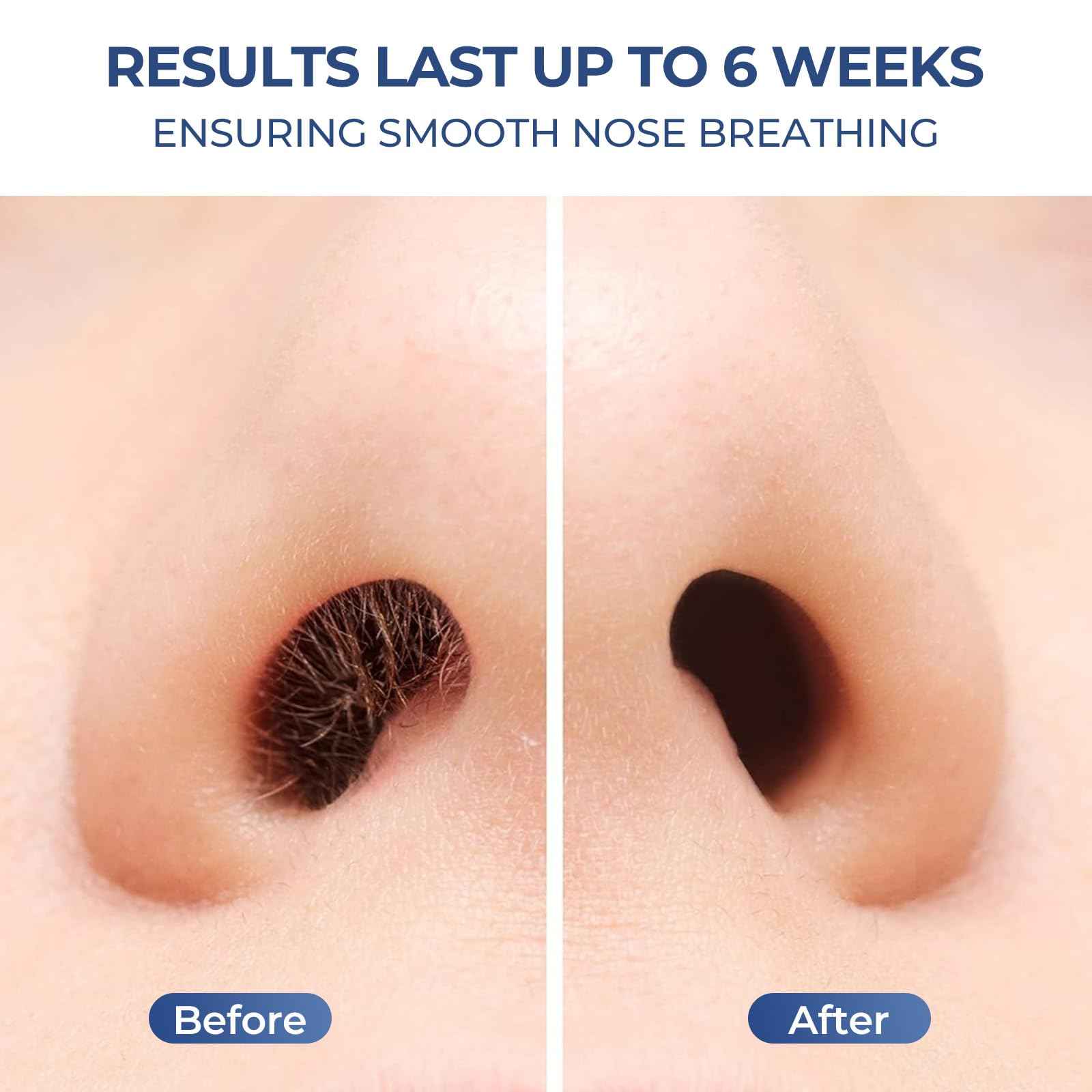 SUERBEATY Nose Wax Kit Men, Nose Hair Wax Kit with 100 g Nose Wax, Use 20 Times, Nose and Ear Hair Removal Kit For Men, USB Fast Heat, Constant Temperature, Multi-Accessories, Travel Use, Light Black