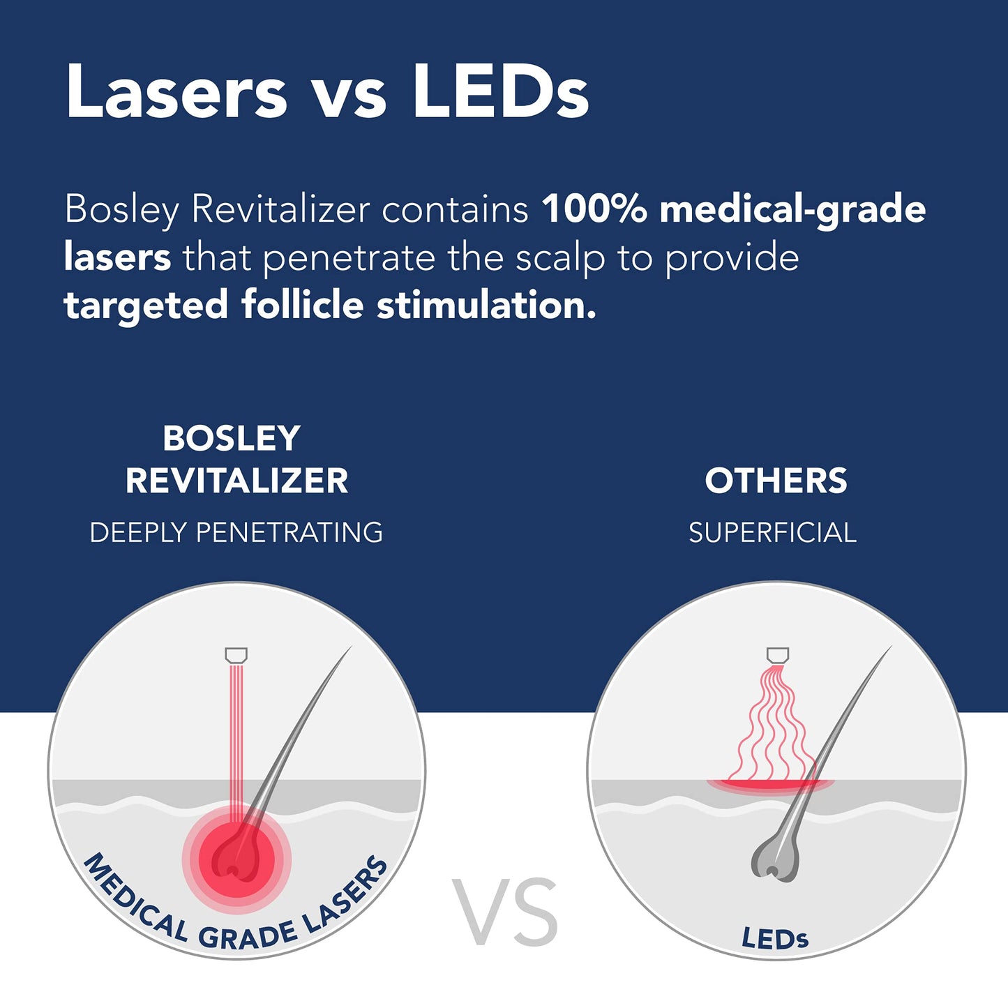 Bosley Revitalizer 272 Flex 100% Laser No LEDs Hair Growth Cap (LLLT) Men and Women - Regrowth, Home Treatment, Thicker, Fuller, Healthy Hair, FDA Cleared. Medium/Small Size