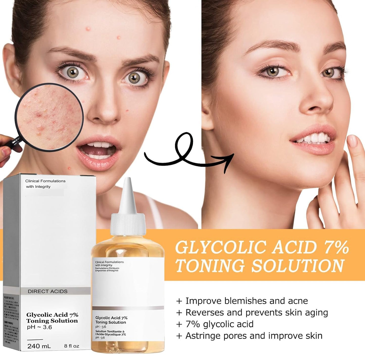 Generic 240ml 8Fl Oz Glycolic Acid 7% Toning Resurfacing Solution,Exfoliate,and Rejuvenate Your Skin, Hydrate,Solution for Blemishes and Acne (1PC)