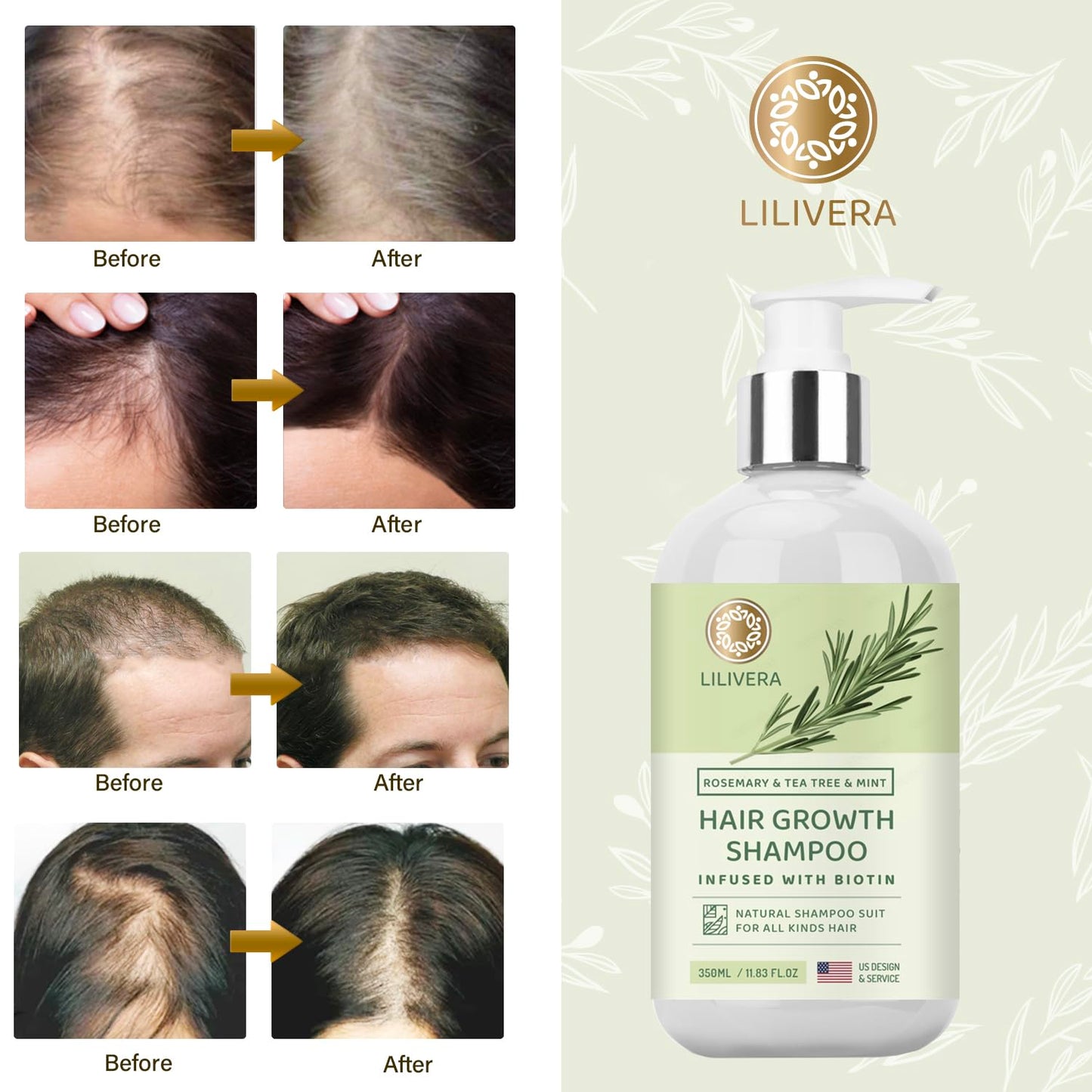 Lilivera Rosemary Hair Growth Shampoo: Shampoo for Hair Loss - Shampoo for Thinning Hair for Men and Women - Rosemary Mint Strengthening Shampoo with Tea Tree Oil Bition - 11.8 fl. oz