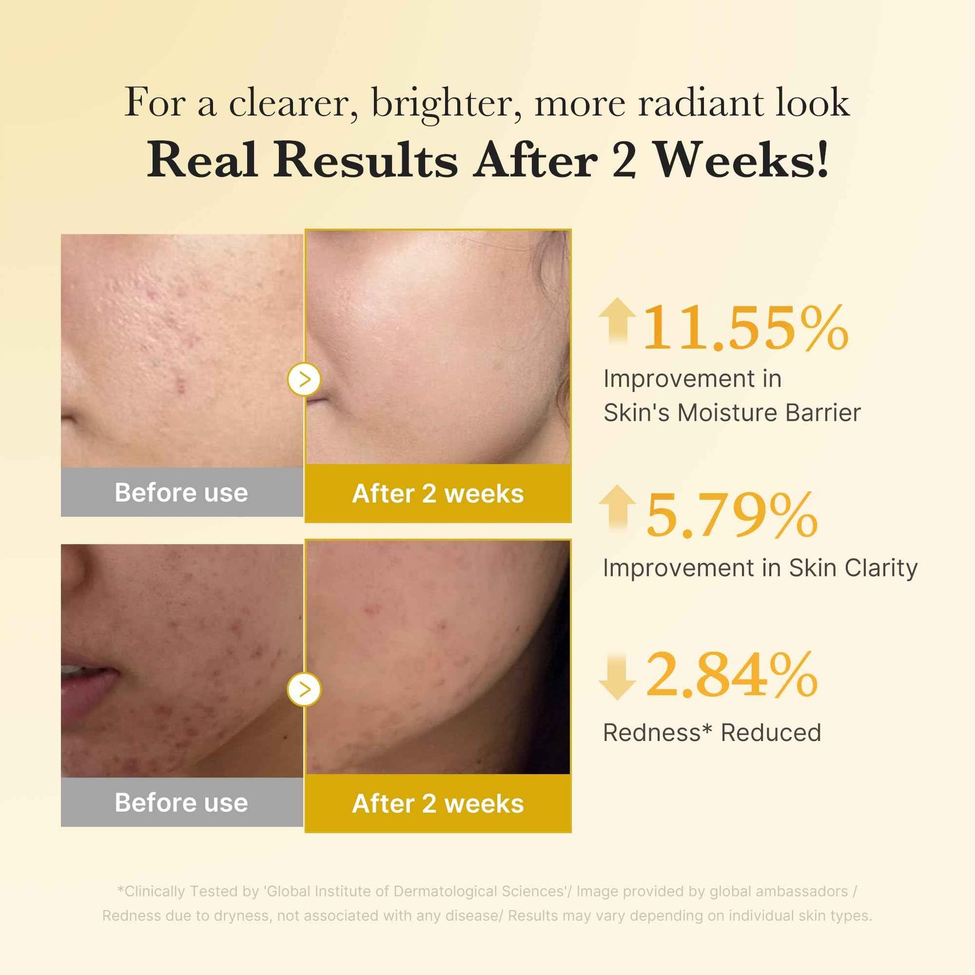 medicube Kojic Acid Overnight Care & Nourish Duo for Troubled Skin: Kojic Acid Turmeric Overnight Wrapping Peel Off Mask and Kojic Acid Turmeric Clarifying & Balancing Capsule Serum