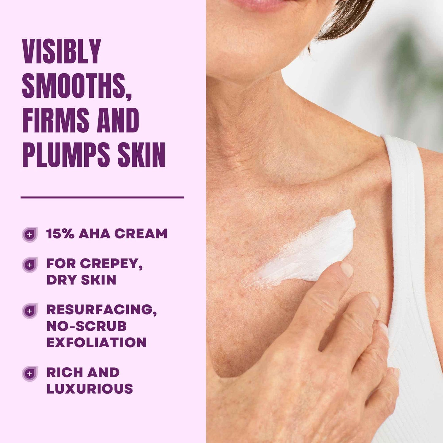 AmLactin Crepe Firming Cream - Therapeutic Skin Tightening Cream for Body – No-Scrub Exfoliator and Moisturizer with 15% Lactic Acid AHA, 12 oz (Packaging May Vary)