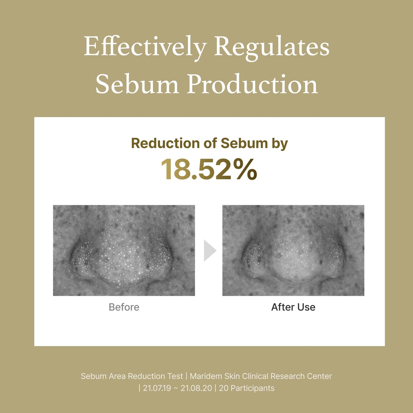 I'm from Mugwort Essence 5.4 fl oz + Mugwort mask 1.01 fl oz, Korean artemisia, help calm redness, irriration for oily skin