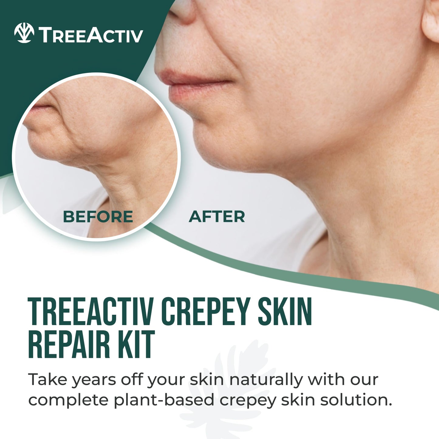 TreeActiv Crepey Skin Repair Kit, Includes Anti-Aging Exfoliating Body Wash, 8oz, Crepe Skin Cream, 8oz, Skin Tightening Cream for Body and Face. Hydrates and Tighten Dry Crepe Skin, Crepe Skin Cream