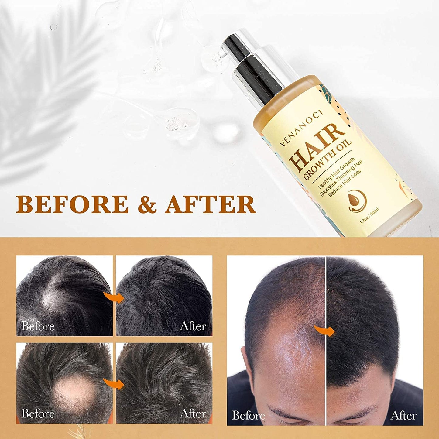 Biotin & Castor oil & Rosemary Oil for Hair Growth for Women, hair loss treatments for dry damaged hair and growth, Serum for Thicker Longer Fuller Healthier Hair, All Natural Vitamin Rich Treatment