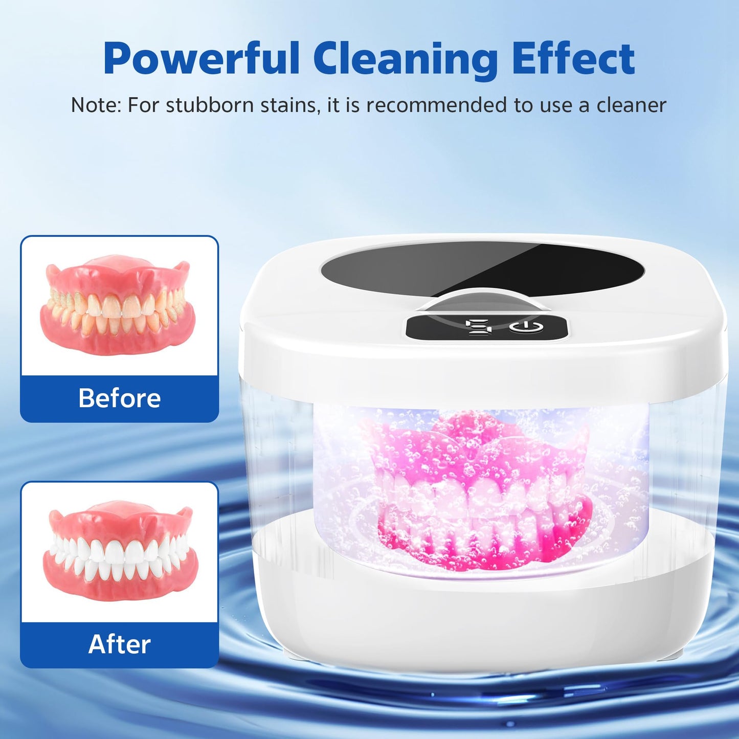 Professional Ultrasonic Retainer Cleaner Retainer Cleaning Machine - 45kHz Ultrasonic Cleaning, Suitable for Denture Mouth Guard Aligner Dental Trays