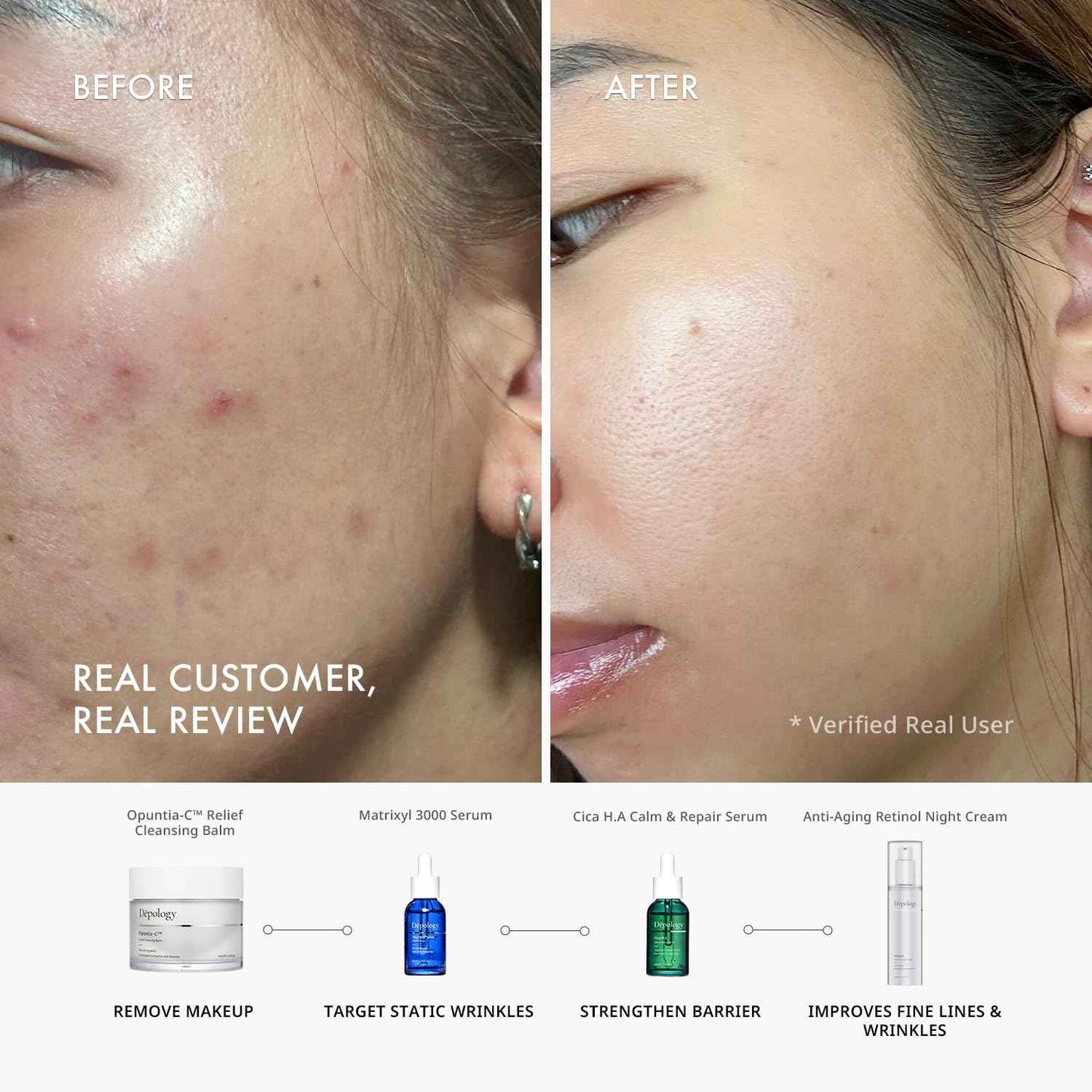 Depology CICA H.A Calm & Repair Serum | Reducing Discomfortable and Sensitivity Face Serum | Hydrating & Replenishing Facial Skin Care Product | Providing Relief from Redness Serum 1.01 fl.Oz