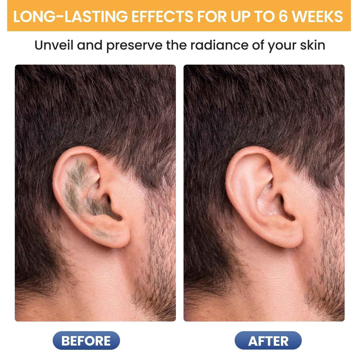 SUERBEATY Ear Nose Wax Kit Men, Nose Hair Waxing Kit for Men, Ear Hair Removal Wax 100g, 20 Pcs Nose Applicator, 15-20 Times, Usb Rapid Heating, Constant Temperature, Painless, Black