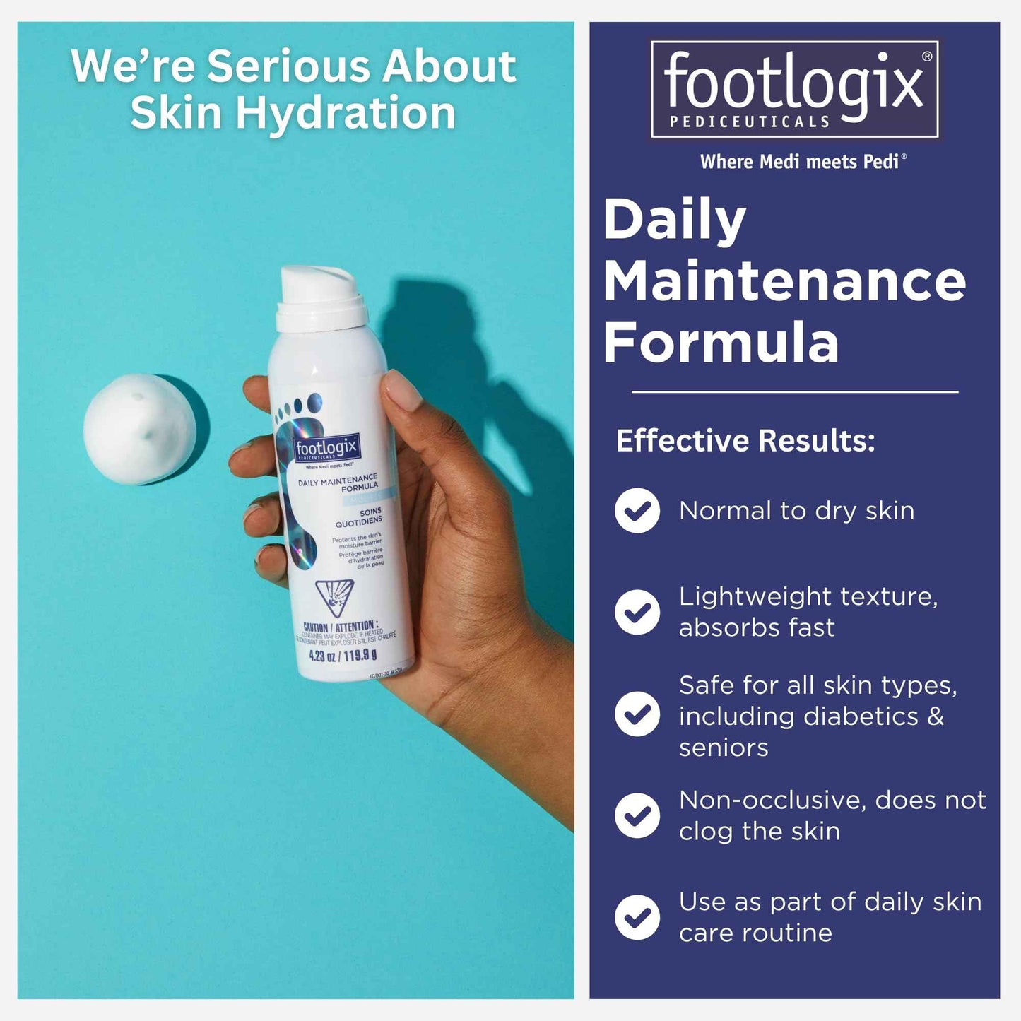 FOOTLOGIX Daily Maintenance Formula - Foot Moisturizer, Foot Mousse for Normal to Dry Skin Maintenance, Foot Mousse for Calluses and Dry Feet, 4.23oz