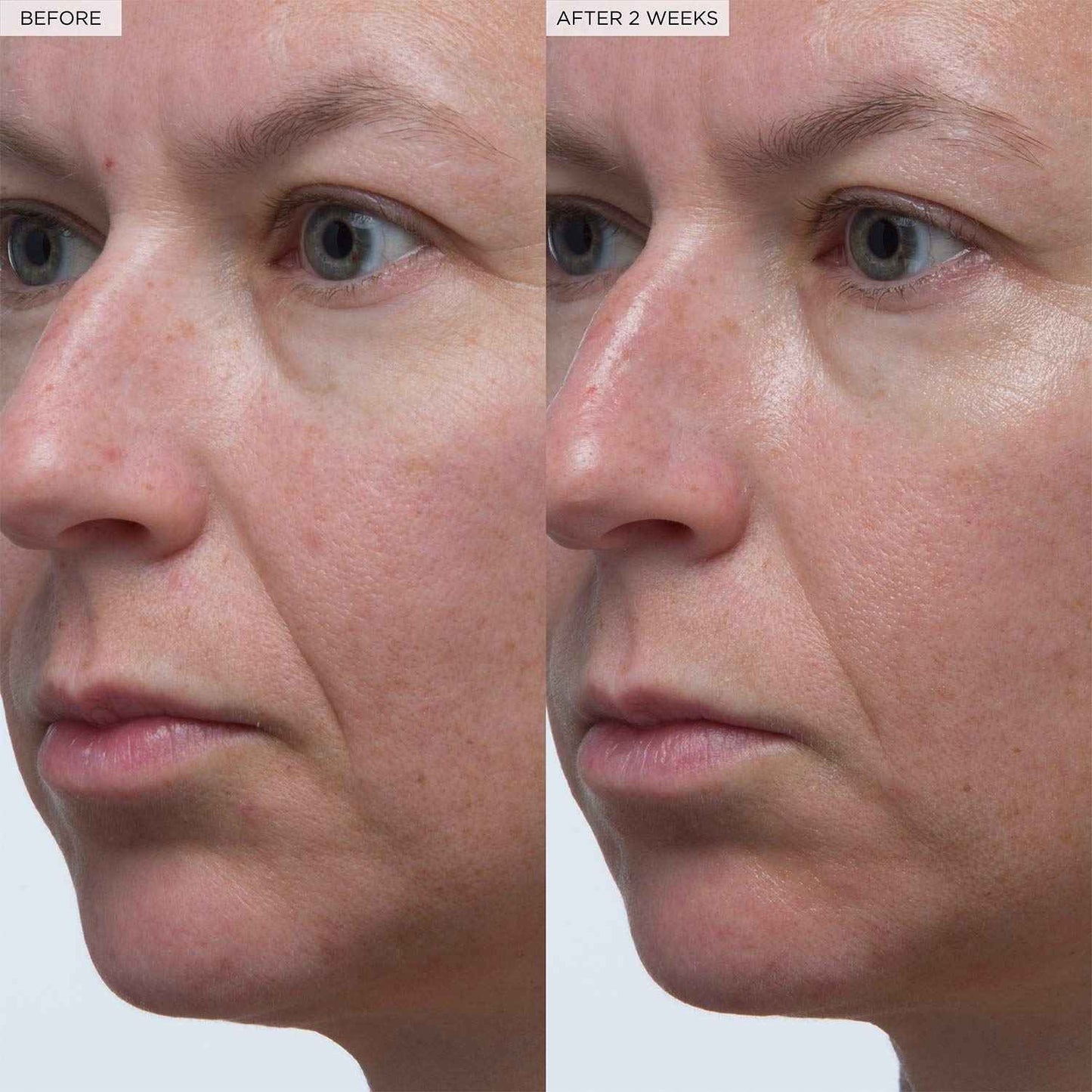 Glow Recipe Plum Plumping & Hydrating Hyaluronic Acid Korean Skin Care Serum - Antioxidant Anti Aging Face Serum + Vitamin B5 for Lasting Skin Barrier Repair & Firming Lines & Wrinkles - Vegan, 30ml