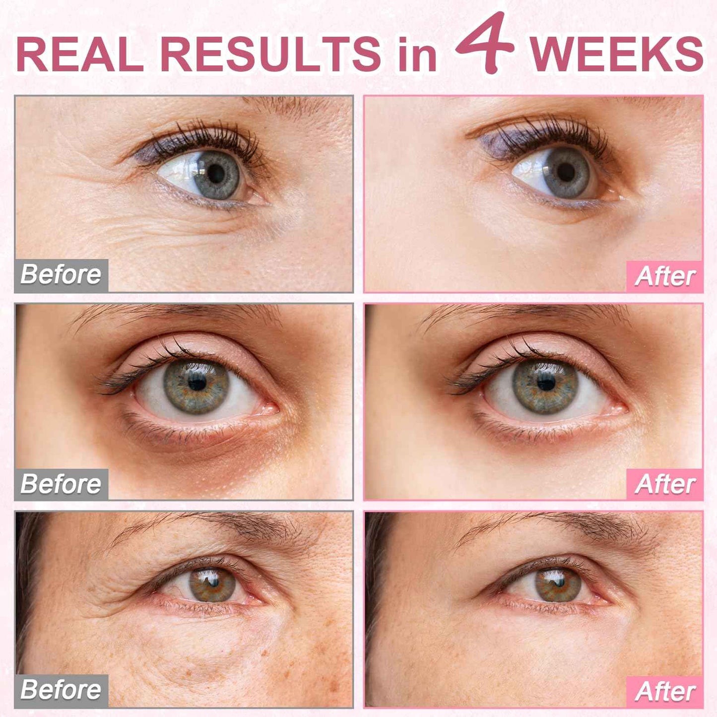 OMPLEN 5% Caffeine Eye Serum Treatment,Hyaluronic Acid & Niacinamide, Under Eye Cream for Dark Circles, Anti Aging 360° Massage Rollerball - Reduce Puffiness, Wrinkles & Fine Lines, 0.5 fl. oz