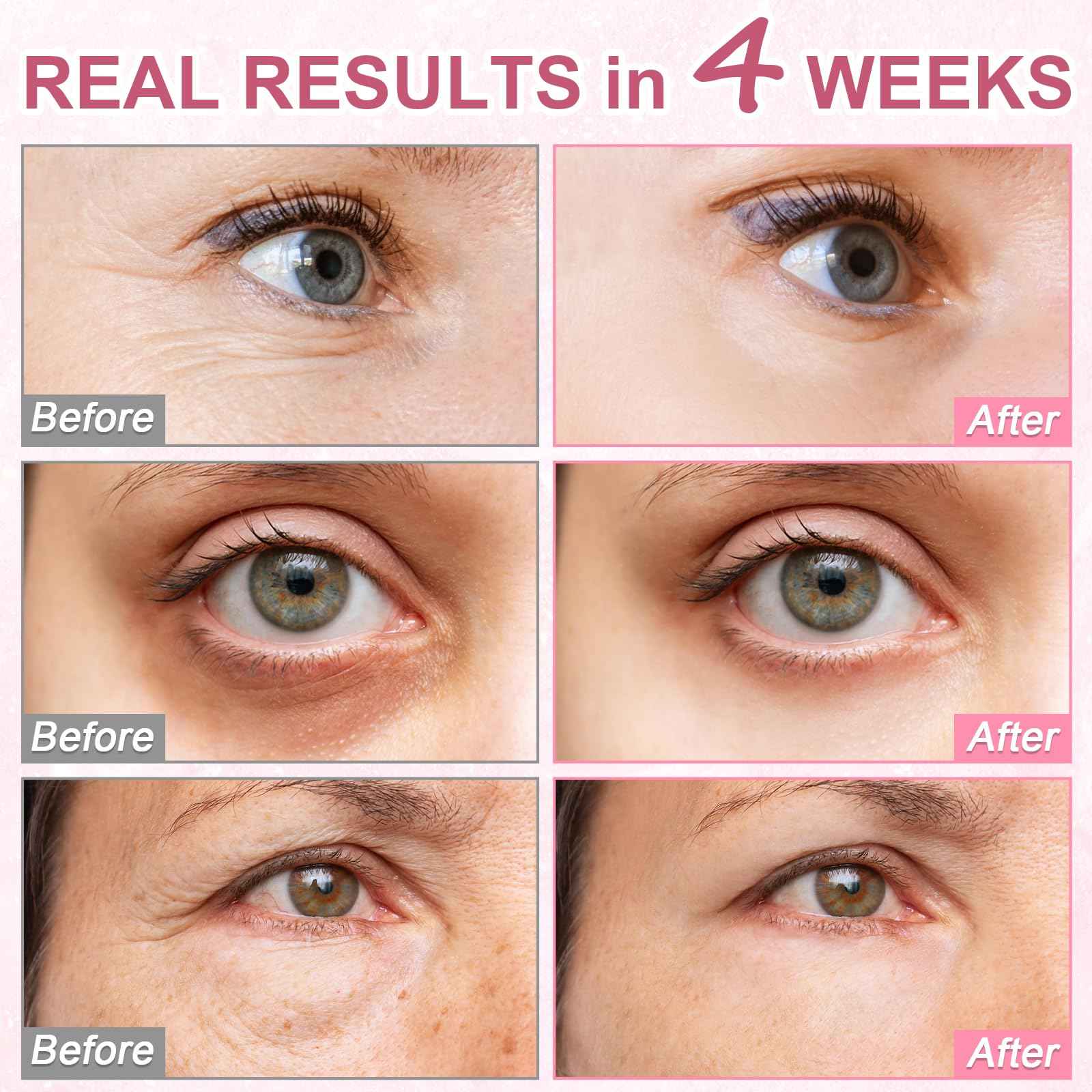 OMPLEN 5% Caffeine Eye Serum Treatment,Hyaluronic Acid & Niacinamide, Under Eye Cream for Dark Circles, Anti Aging 360° Massage Rollerball - Reduce Puffiness, Wrinkles & Fine Lines, 0.5 fl. oz