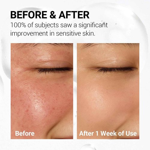 NEAF NEAF Soothing Calm Toner Pad, Daily Gentle Exfoliating & Hydrating Facial Pads for Intense Soothing Care, Heartleaf Extract and CICA for Sensitive Skin Safe, Korean Skincare (60 Pads)