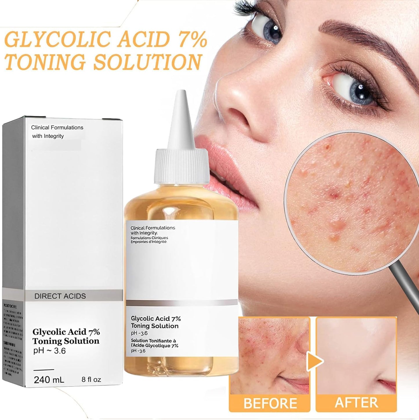 Generic 240ml 8Fl Oz Glycolic Acid 7% Toning Resurfacing Solution,Exfoliate,and Rejuvenate Your Skin, Hydrate,Solution for Blemishes and Acne (1PC)