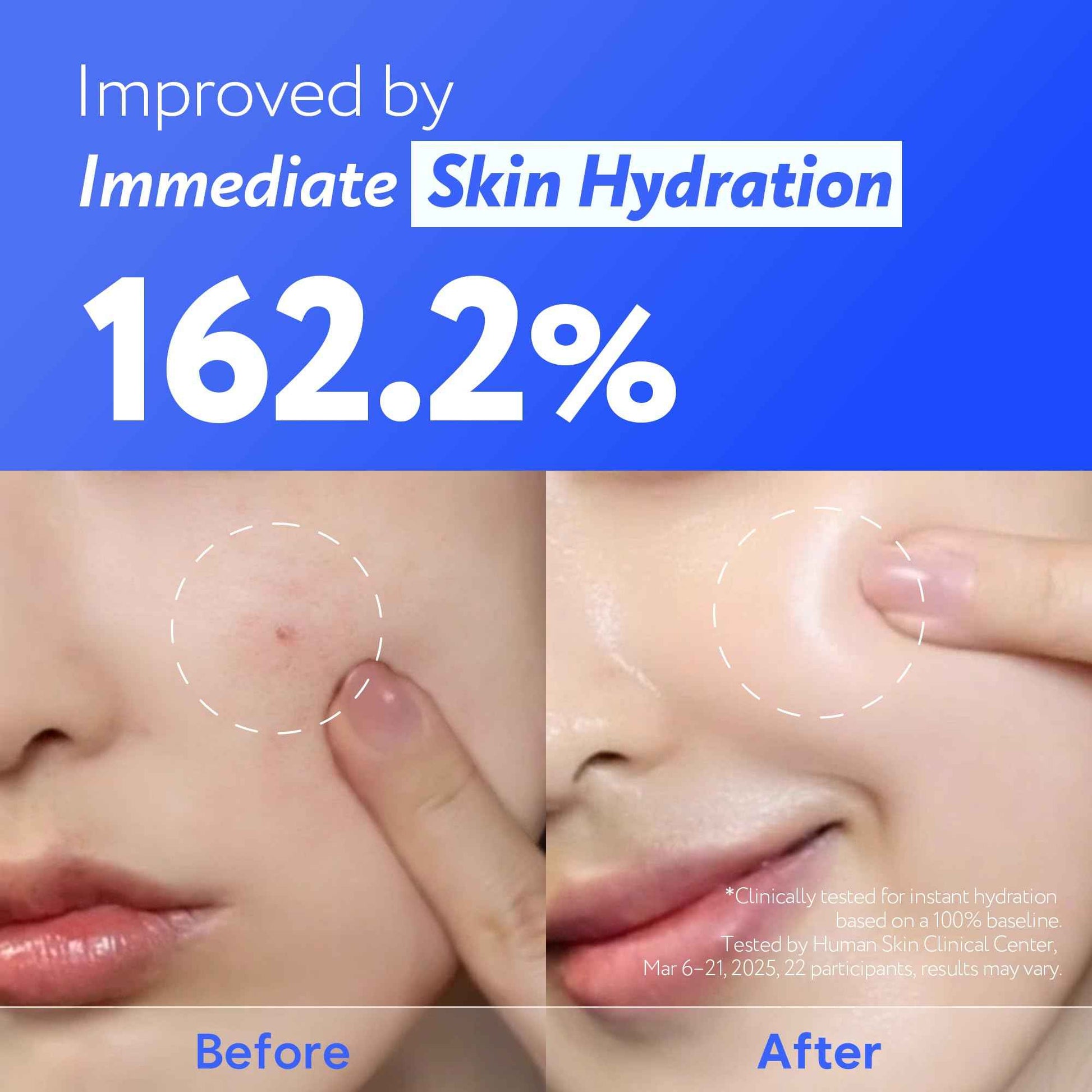 SOONDING Coconut Water Glow Calming Serum | Hydrating & Soothing Serum with Panthenol, Niacinamide & Cica | Centella Asiatica | Barrier Repair for Sensitive Skin | Korean Skin Care (30ml / 1.01 fl oz)