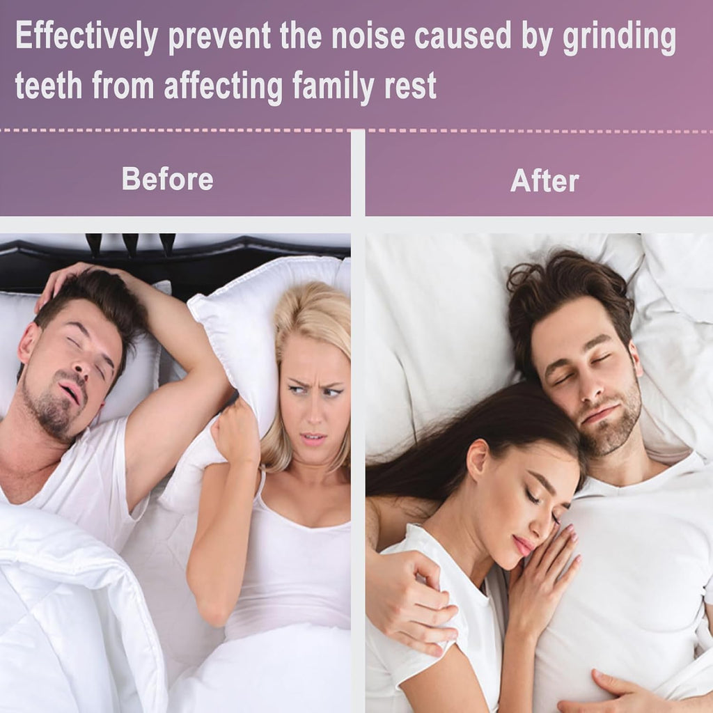 Mouth Guard for Grinding Teeth at Night,8 Pack Night Guards for Teeth Grinding,2 Size Mouth Guard for Sleeping,Reusable Mouth Guards for Clenching Teeth at Night