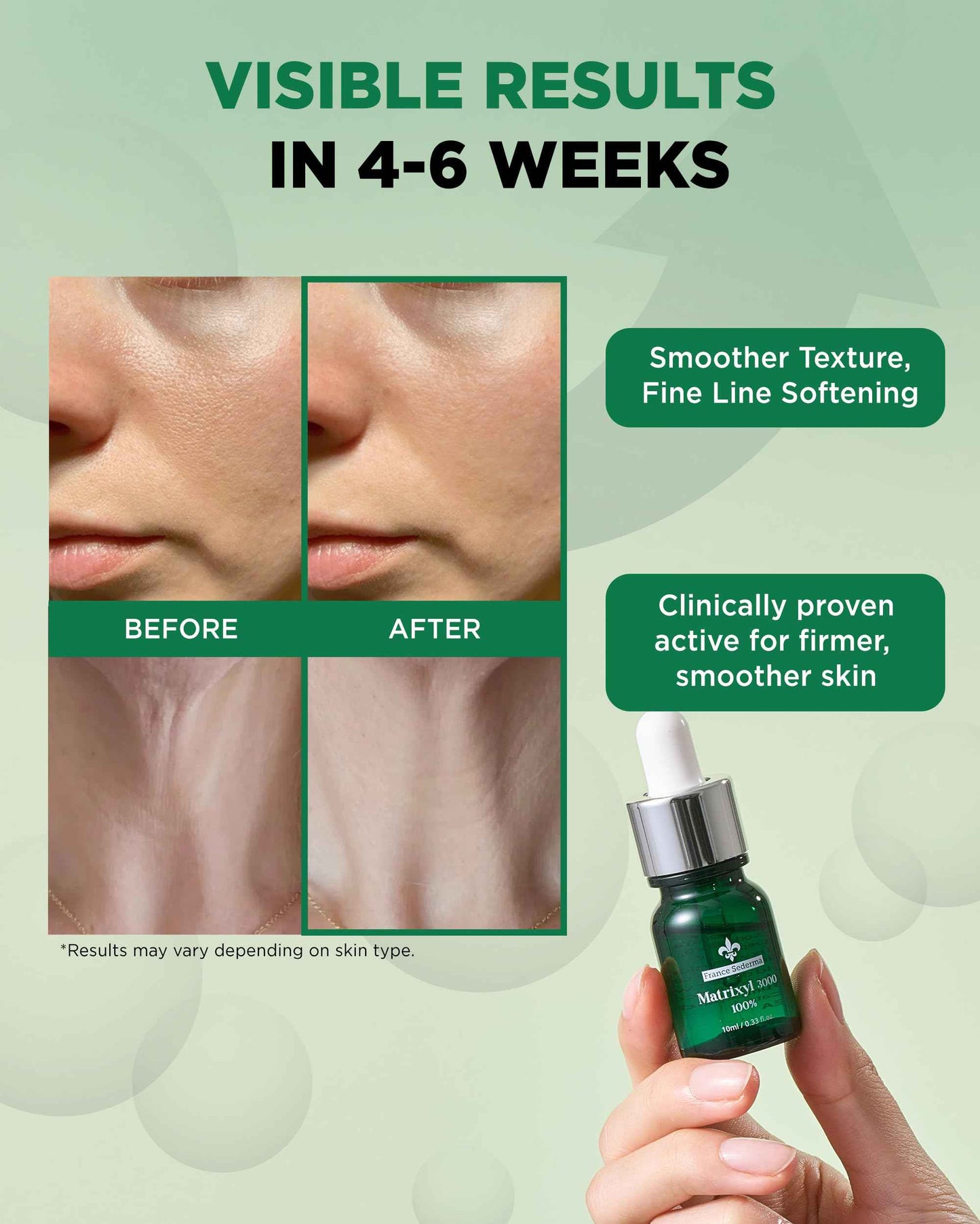 Matrixyl 3000 100% Serum Skincare – Pure Peptide Complex Anti-Aging Facial Ampoule from France Sederma, Collagen Boosting Wrinkle Treatment, Perfect for Layering & DIY, 0.33 fl.oz (10ml) 2 Pack