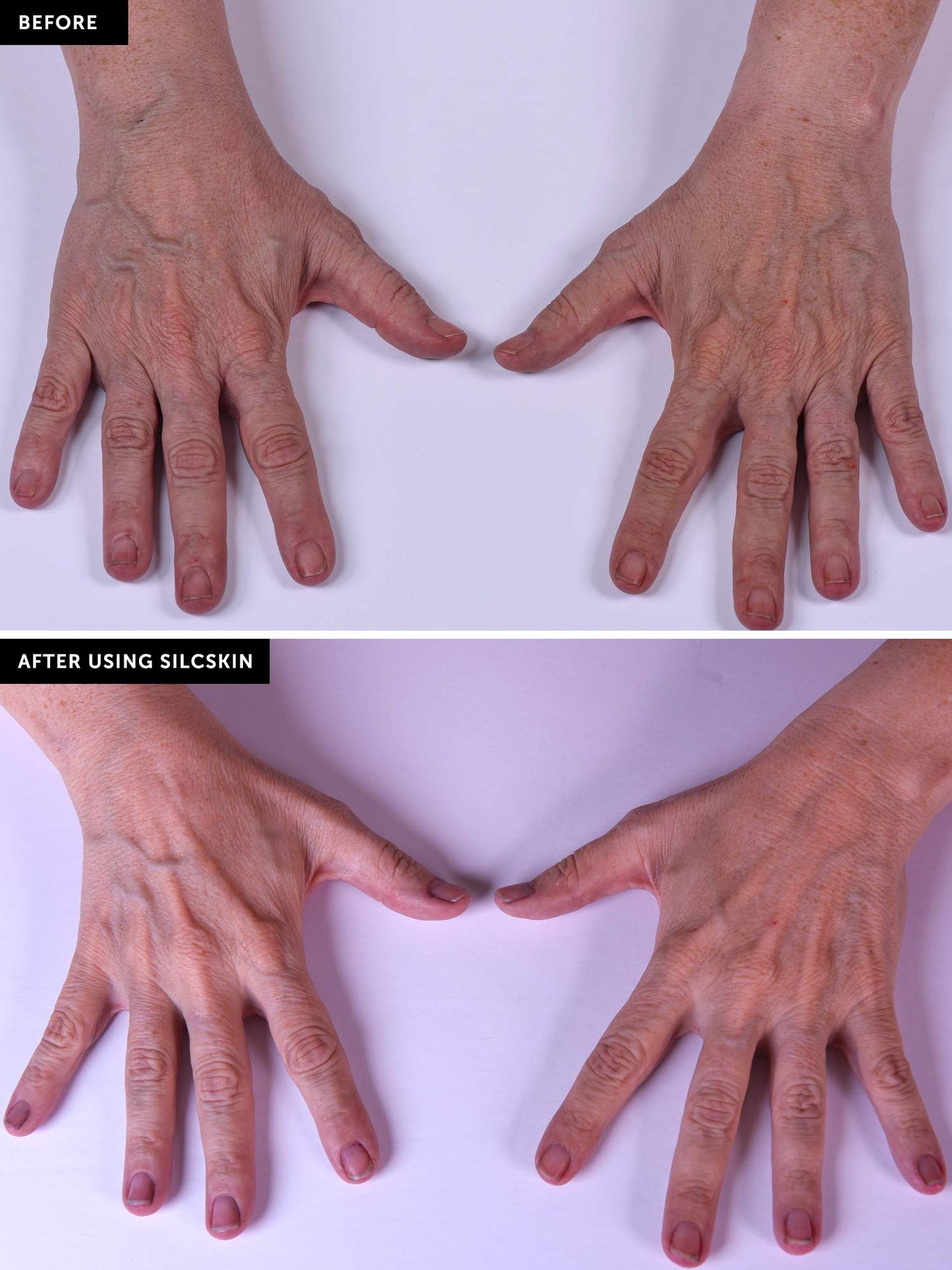 SilcSkin Hand & Body Treatment - Uses Medical Grade Silicone for Improved Collagen and Hydration - For Crepey Skin and Fine Lines - 4 oz