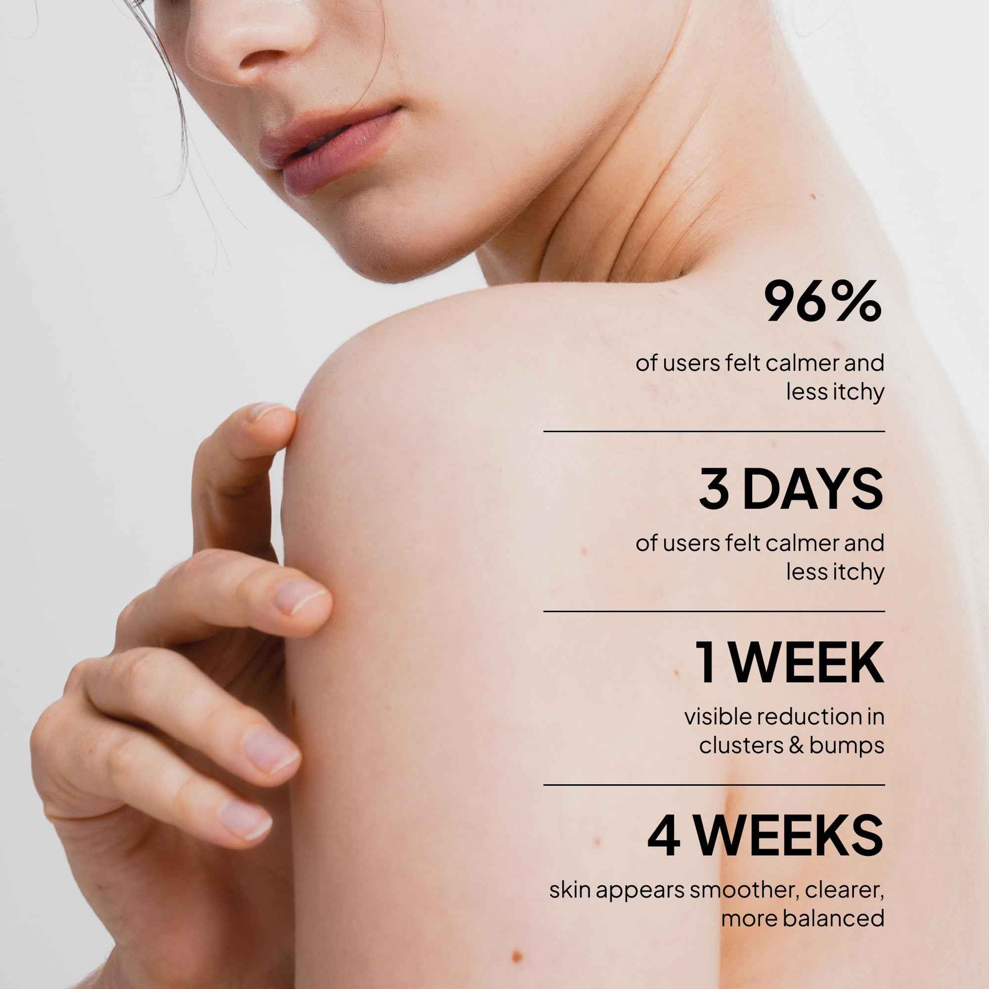 BellamiLuxx Fungal Acne Treatment Lotion: Effective Face & Body Pimple Cream for Bumps, Clusters, Itch & Redness – Fungal Prone Skin Acne Treatment Moisturizer for Teens & Adults with Natural Actives