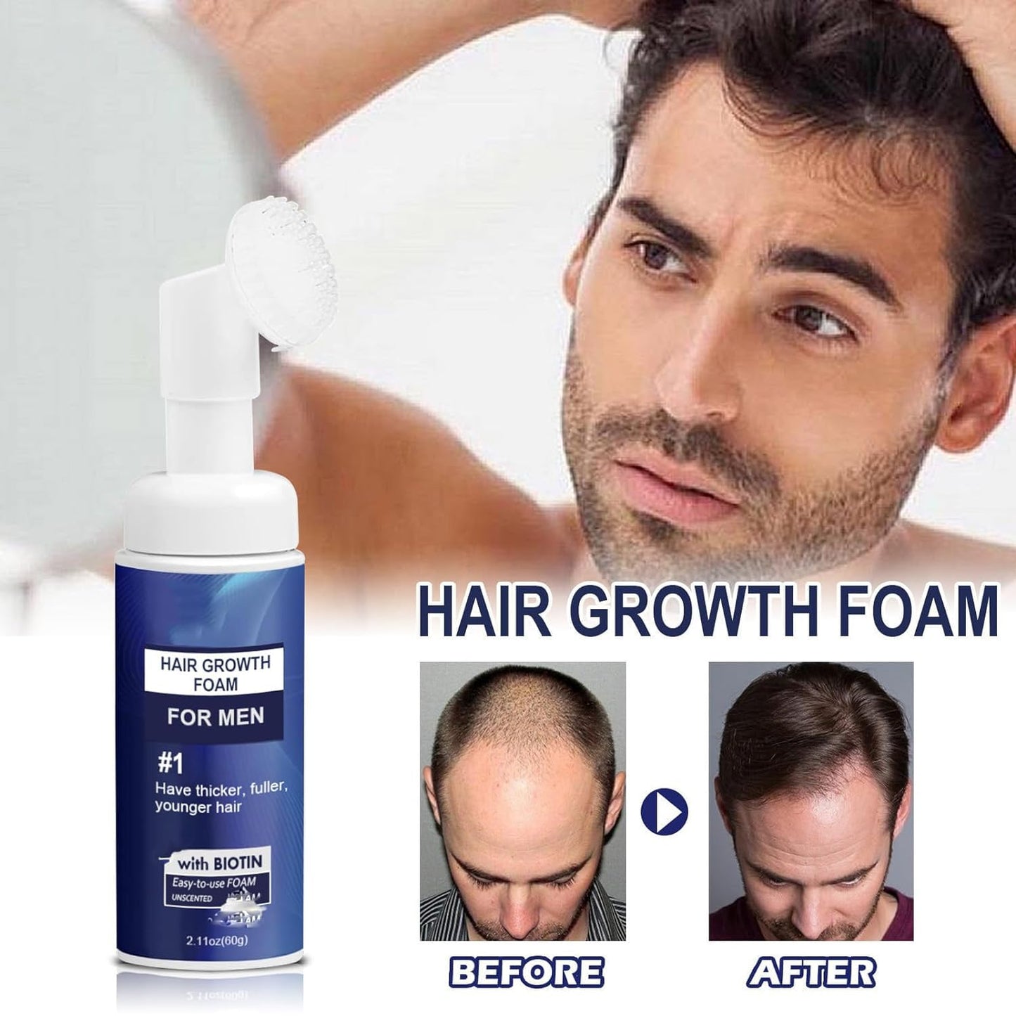 Renew Hair X Men, Renewhair-X, Renewhairx Men, Renew Hair X, Renewhairx, Renewhairx Hair Growth Foam, Renewhairx Hair Growth Foam for Men, Renewhairx Hair Growth (120g)