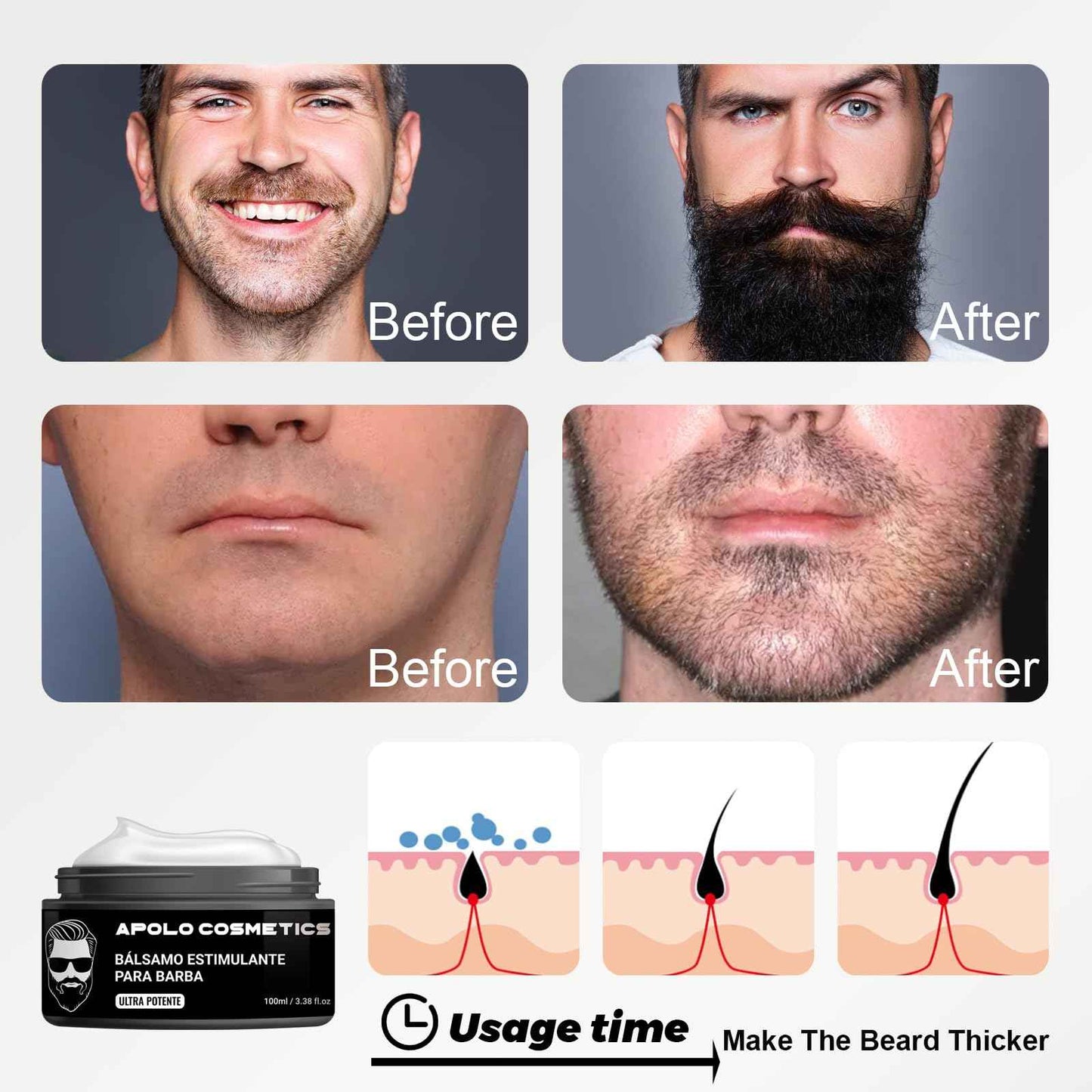 apolo cosmetics Para Barba, Ultra Potente Estimulante de Barba, Bálsamo para Crecimiento de Barba Crema, Beard Growth Blam, Softner/Unscented Beard Butter, Sin Irritación 100ml/3.38floz (1 PC, 1)