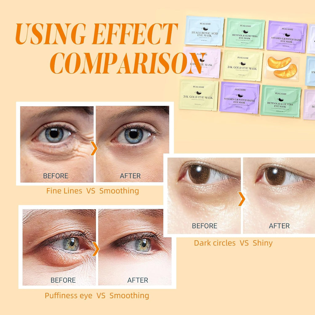Under Eye Patches Gold and Hyaluronic Acid for puffy eyes,Rose Eye Masks for Dark Circles and Puffiness skin care Smooth Wrinkles products 30 Pairs