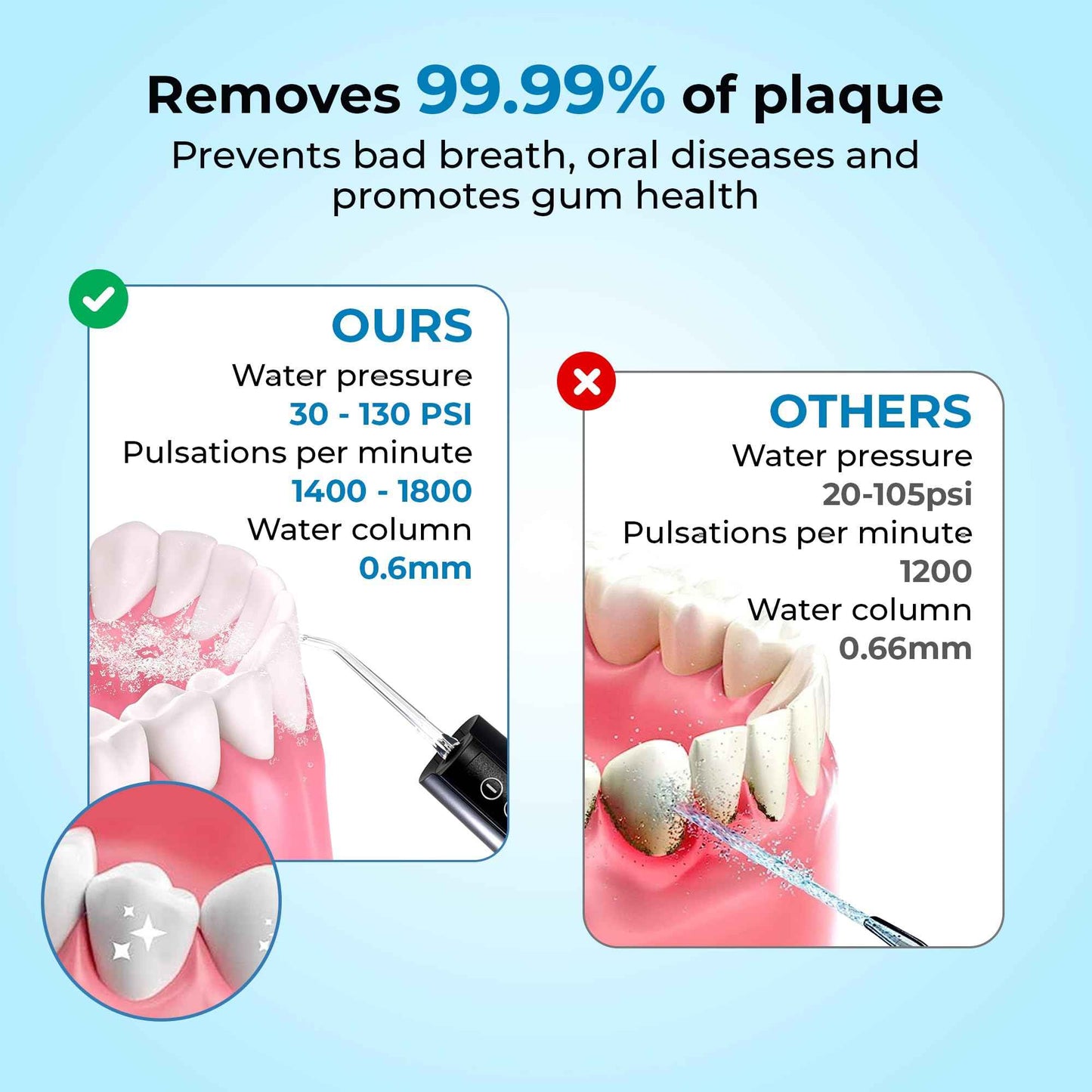 Water Flosser for Braces & Tonsil Stone Remover, 400ml Tank, IPX8 Waterproof, Dental Floss with 6 Tips Including Tongue Scraper, Oral Irrigator for Teeth, Bad Breath Treatment for Adults