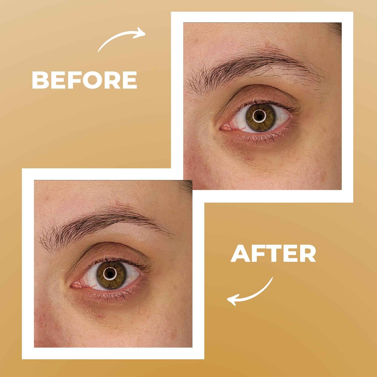 Fab Brows Professional-Grade Tweezers | Stainless Steel Eyebrow Tweezers for Women | Multipurpose Flat Tweezers for Facial Hair, Splinters, Ingrown Hair | Seamless Hair Plucking | Women's Grooming