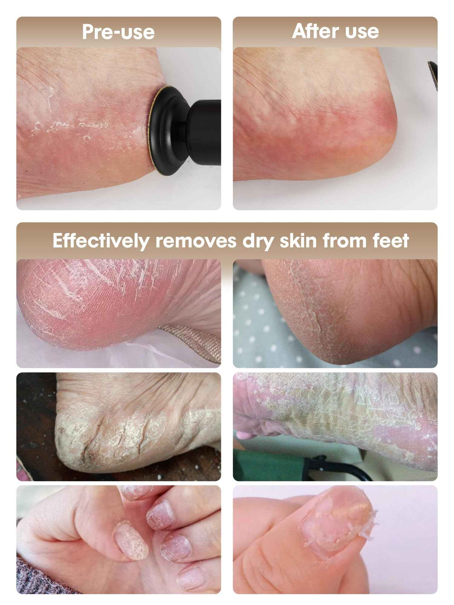 KIUCID Electric Foot Callus Remover - 2 in 1 Cordless Electric Foot File Nail Grinder,Electric Callus Remover for Feet with 3 Modes,Dry Skin Remover for Feet (Black)