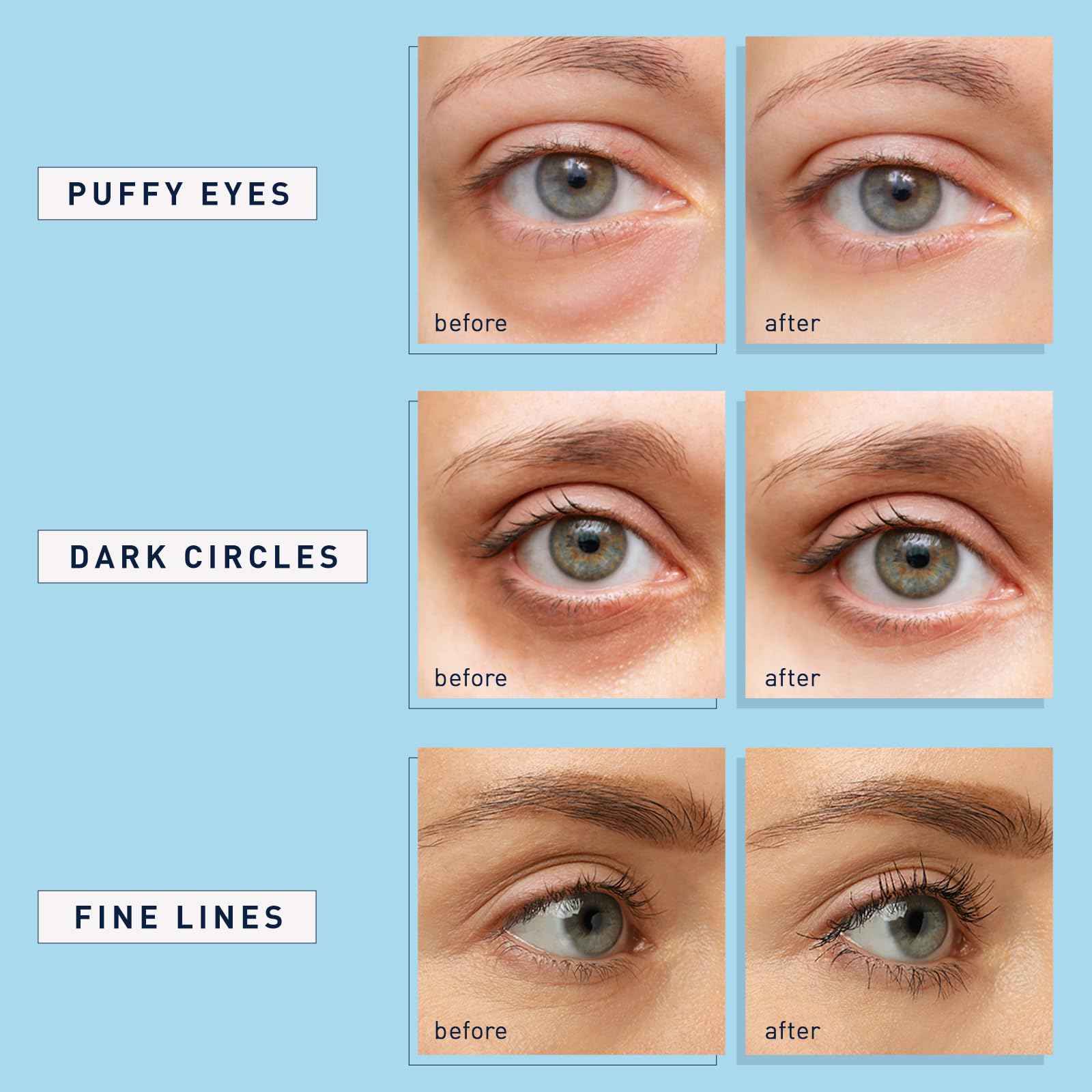 Enaskin Naturals Under Eye Patches for Dark Circles: 60 Pairs Retinol Collagen Eye Gels Mask - Reduce Wrinkles Puffy & Bags - Skin Treatment Pads - Anti Aging Moisturizer For Women (Blue 2 Pack)