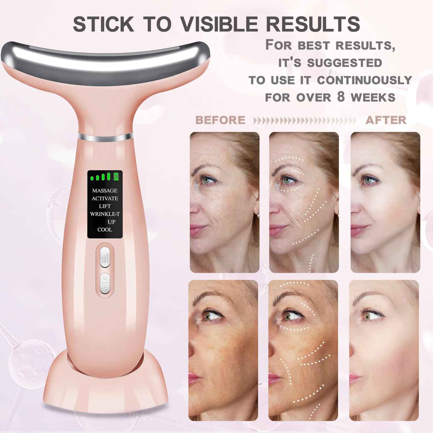 youngfocus Face-Neck-Massager, Vibration, Cooling and Thermal Functions for Multifunctional Skin Care, Anti-Aging Face Massager Improve, Firm, Tightening and Smooth (Pink)