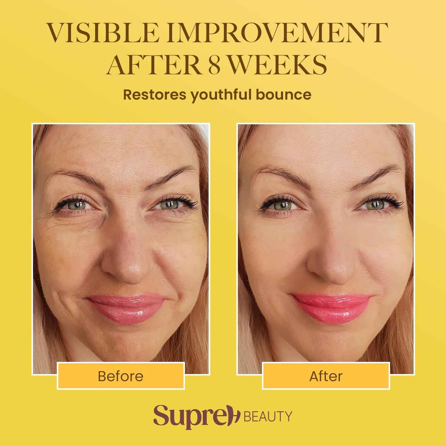 SupreH Bee Venom Wrinkle Cream: Wrinkle Cream for Women with Bee Venom Hyaluronic acid Niacinamide and Peptides - for fine lines and face firming 50