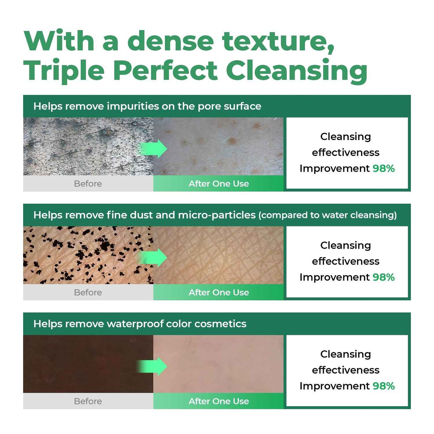 CURE Aloe Vera Foam Cleanser – Hydrating Gentle Korean Face Wash with Aloe & Centella for Sensitive Skin, Pore Care & Deep Cleansing, 3.38 fl oz