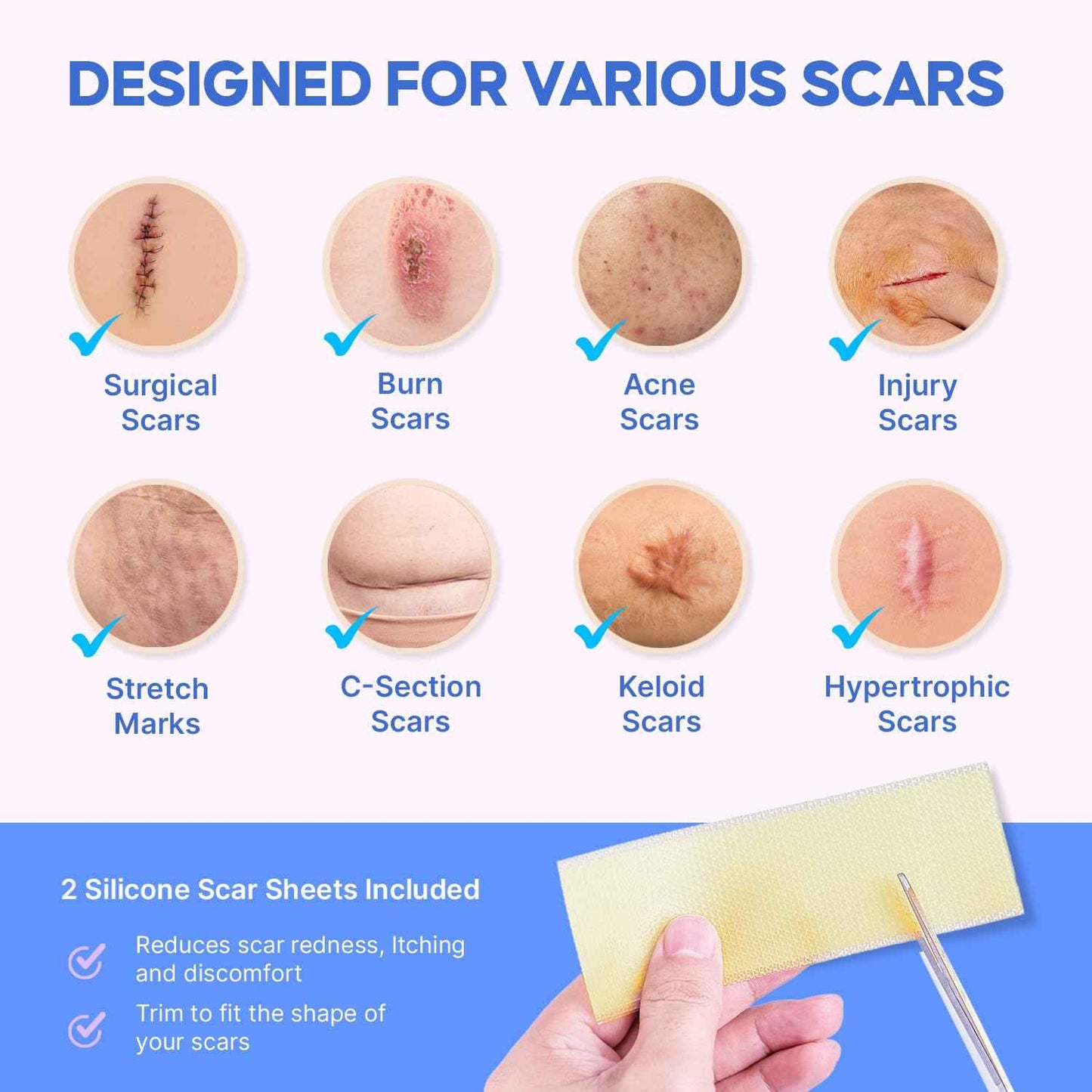 Medical Grade Silicone Scar Gel: Old and New Scars Removal Cream - Intensive Fade Surgical & C-Section Scars, Stretch & Acne Marks, Injury, Burns, Keloids, 30g, 2 Scar Sheets