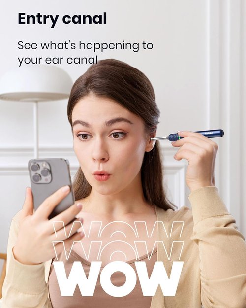 Ear Wax Removal Tool Camera: Ear Camera Otoscope, Bebird Note5 Pro Ear Cleaner Tweezers, 10 Megapixels Earscope Camera, Earwax Removal Kit, 12 Ear Spoon, Hygiene Storage Base, Wax Cleaning Kit (Blue)