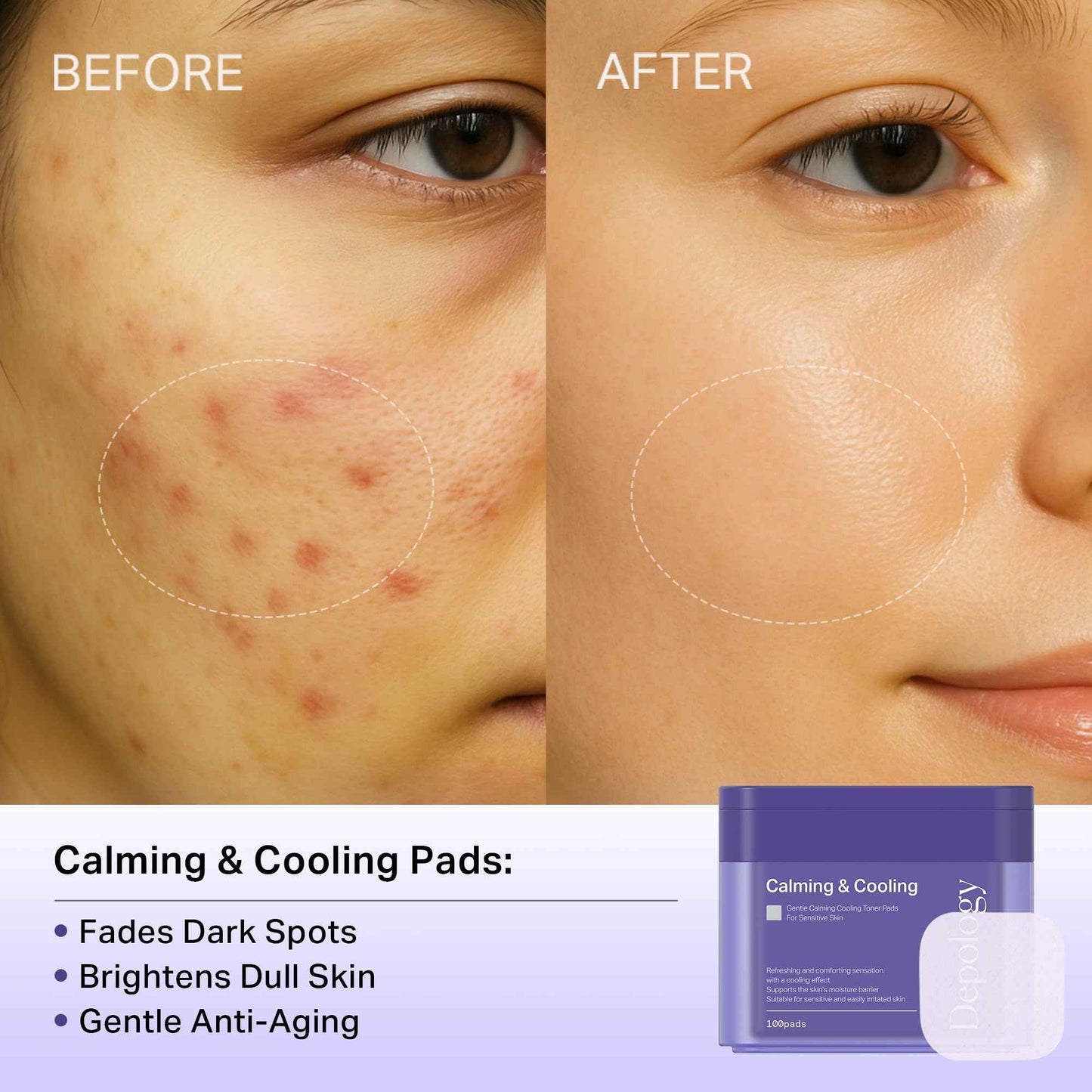 depology Blemish & Tone Toner Pads [Upgraded] – Helps Fade Dark Spots Facial Pads & Uneven Skin Tone with Lactic Acid, Bakuchiol & Centella, Daily Exfoliating for Sensitive Skin