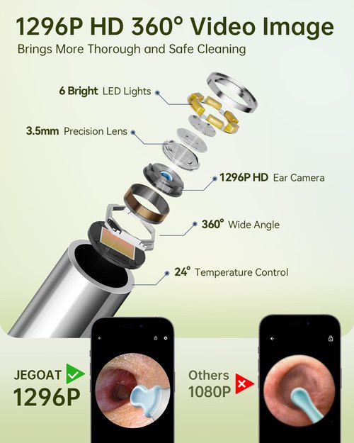 Ear Wax Removal Tool Camera, Ear Cleaner with Camera, Ear Cleaning Kit 1296P HD Ear Scope and 6 LED Lights, 10 Ear Pick Tips, Earwax Removal kit with Otoscope to Earify Earwax for iOS and Android