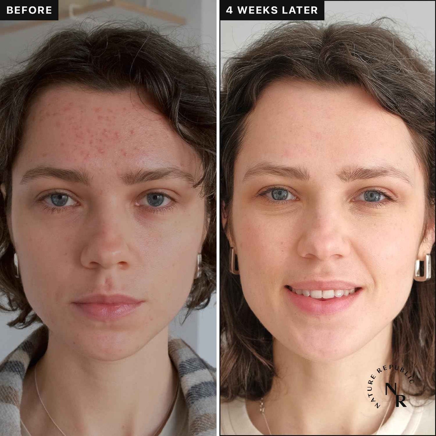 Nature Republic Vitapair C Glow Facial Toner - Vitamin Toners for Face, Hydrating Skin Care for Women, Niacinamide Korean Skincare, Clean Clear Moisturizing, Gentle Natural Beauty, 300ml / 10.15 fl oz