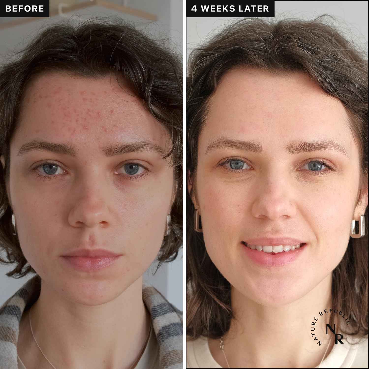 Nature Republic Vitapair C Glow Facial Toner - Vitamin Toners for Face, Hydrating Skin Care for Women, Niacinamide Korean Skincare, Clean Clear Moisturizing, Gentle Natural Beauty, 300ml / 10.15 fl oz