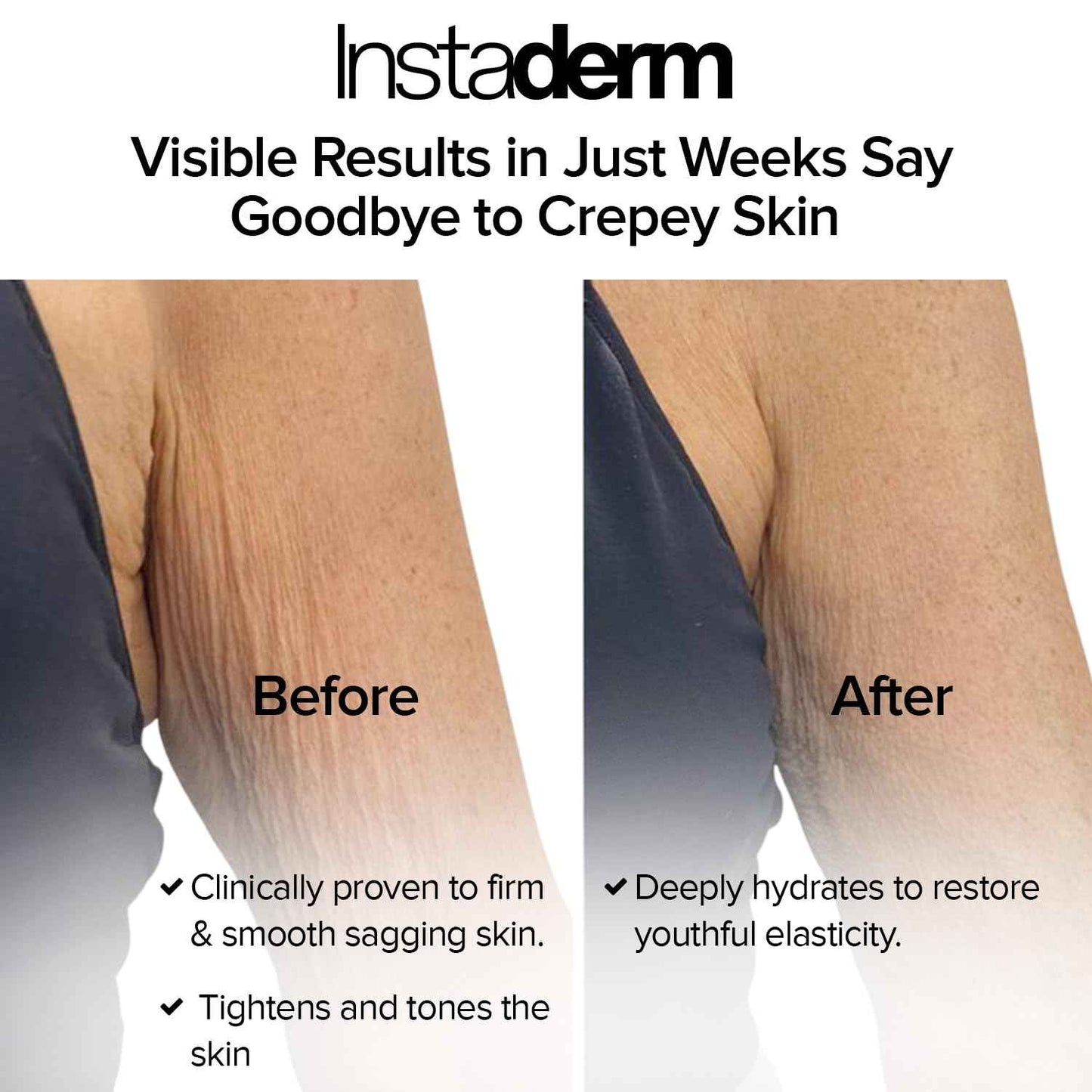 Instaderm Crepe Fix Body Restorative Cream – Anti-Aging Wrinkle Cream, Support Skins Natural Elastin & Collagen Production to Restore, Lift, Tighten, Hydrate & Smooth Thinning Aged Crepey Skin. 4OZ